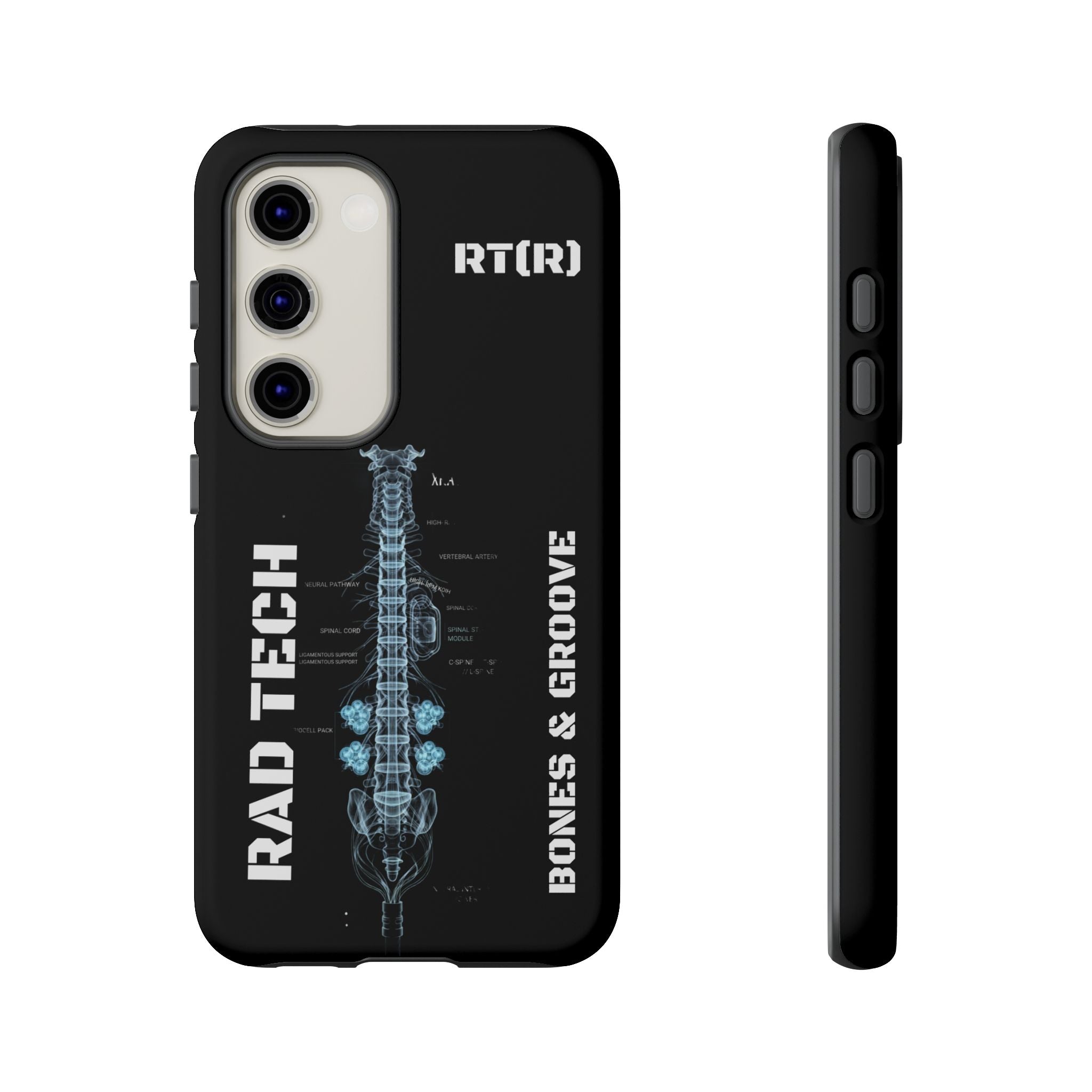 RAD TECH -Aesthetic Phone Case