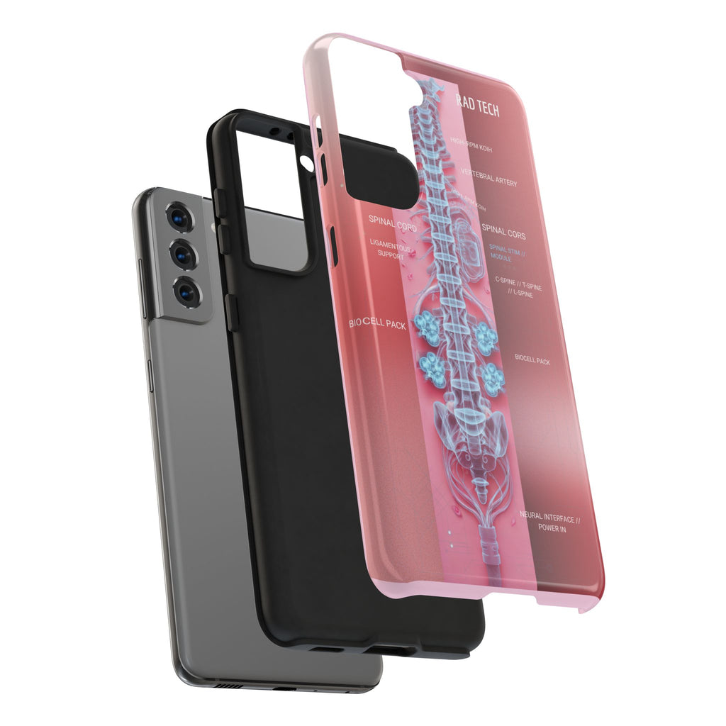 Anatomical Spine Tough Phone Case — Medical X-Ray Design, ‘Spinal Cord’ Labelled