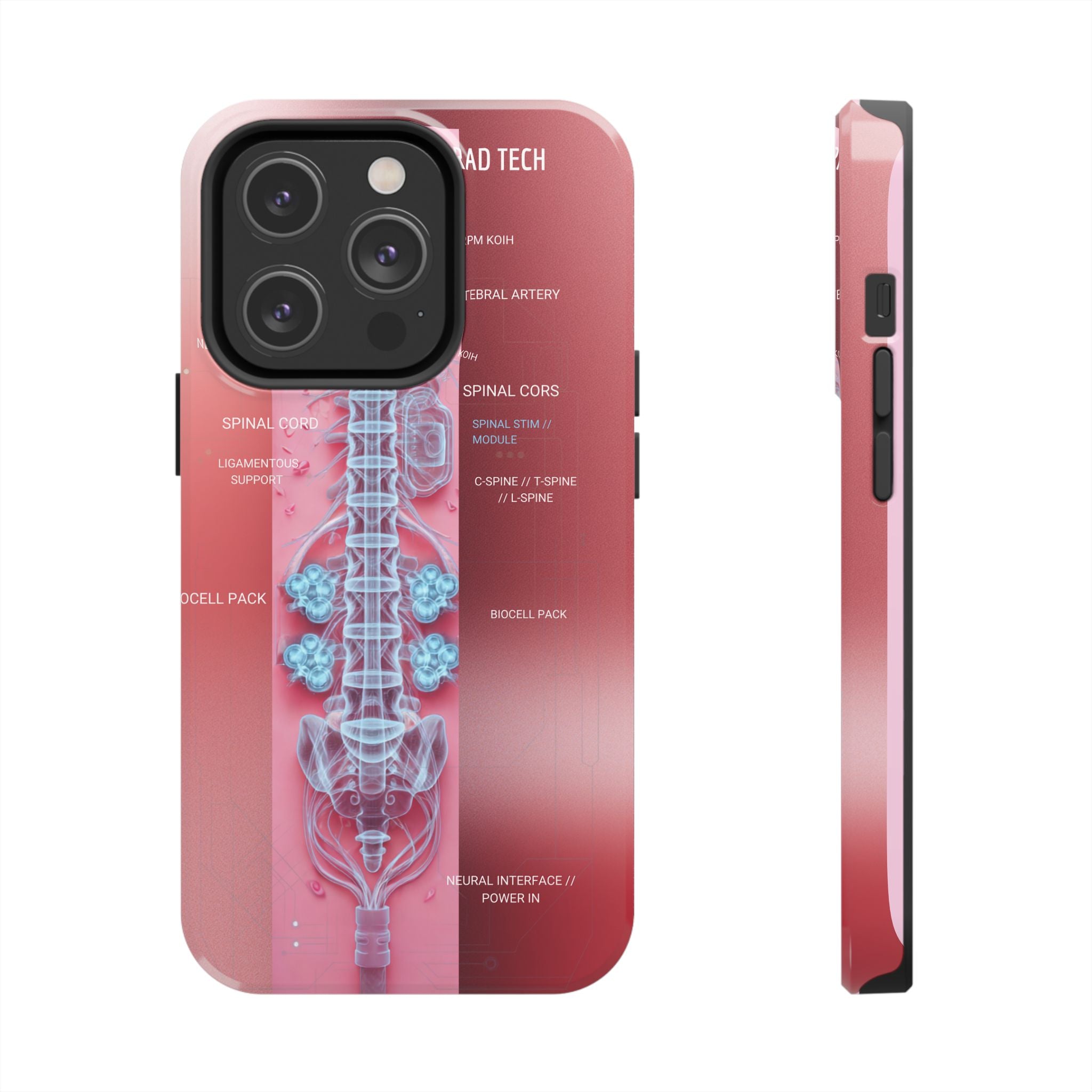 Anatomical Spine Tough Phone Case — Medical X-Ray Design, ‘Spinal Cord’ Labelled