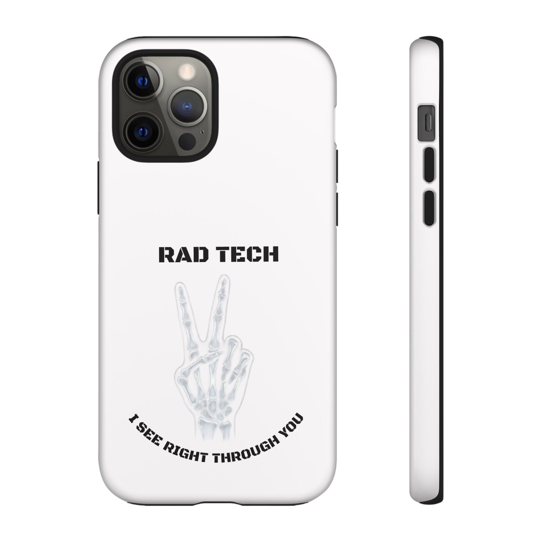 Rad Tech Phone Case — Skeleton Hand "I See Right Through You" X-ray Technician Gift