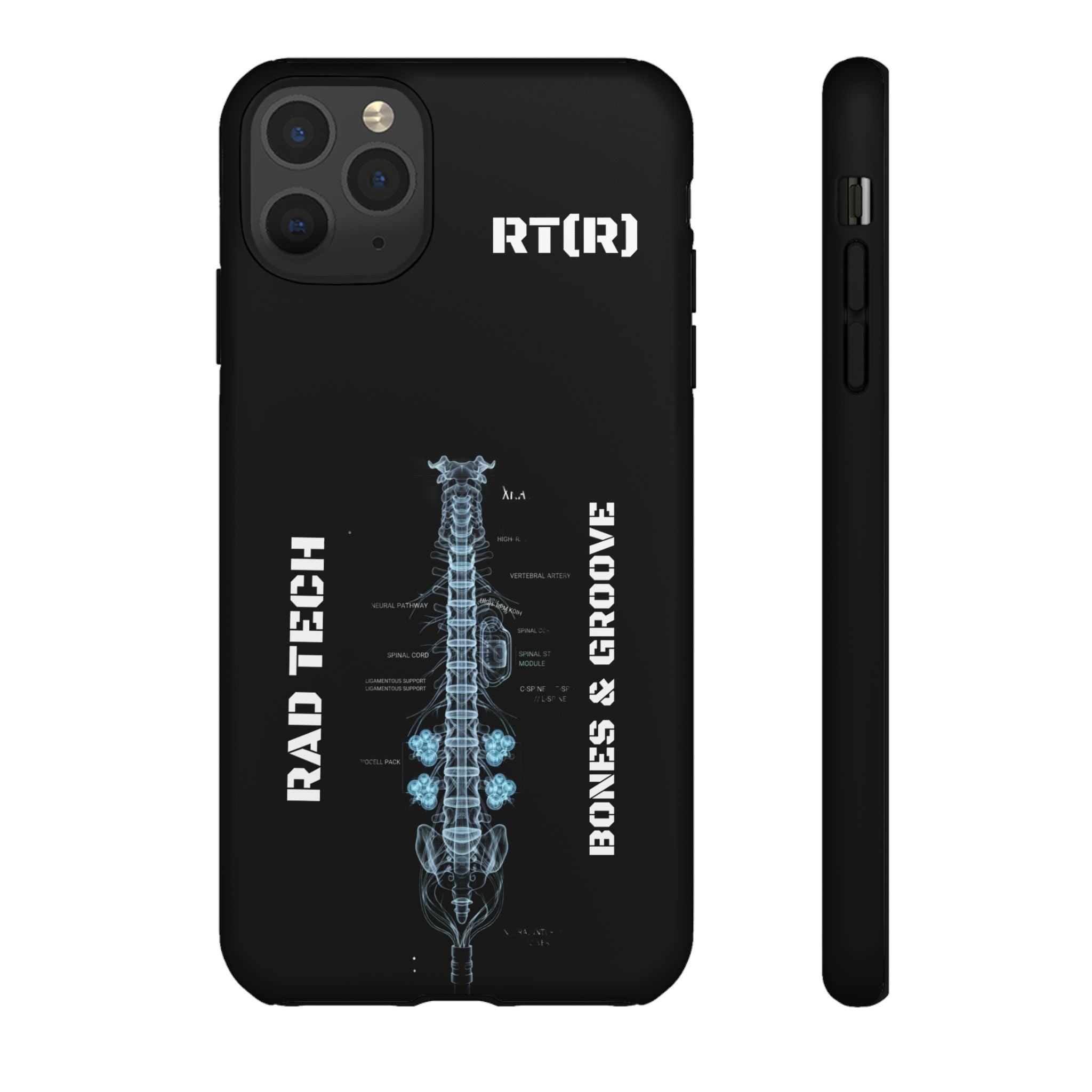 RAD TECH -Aesthetic Phone Case