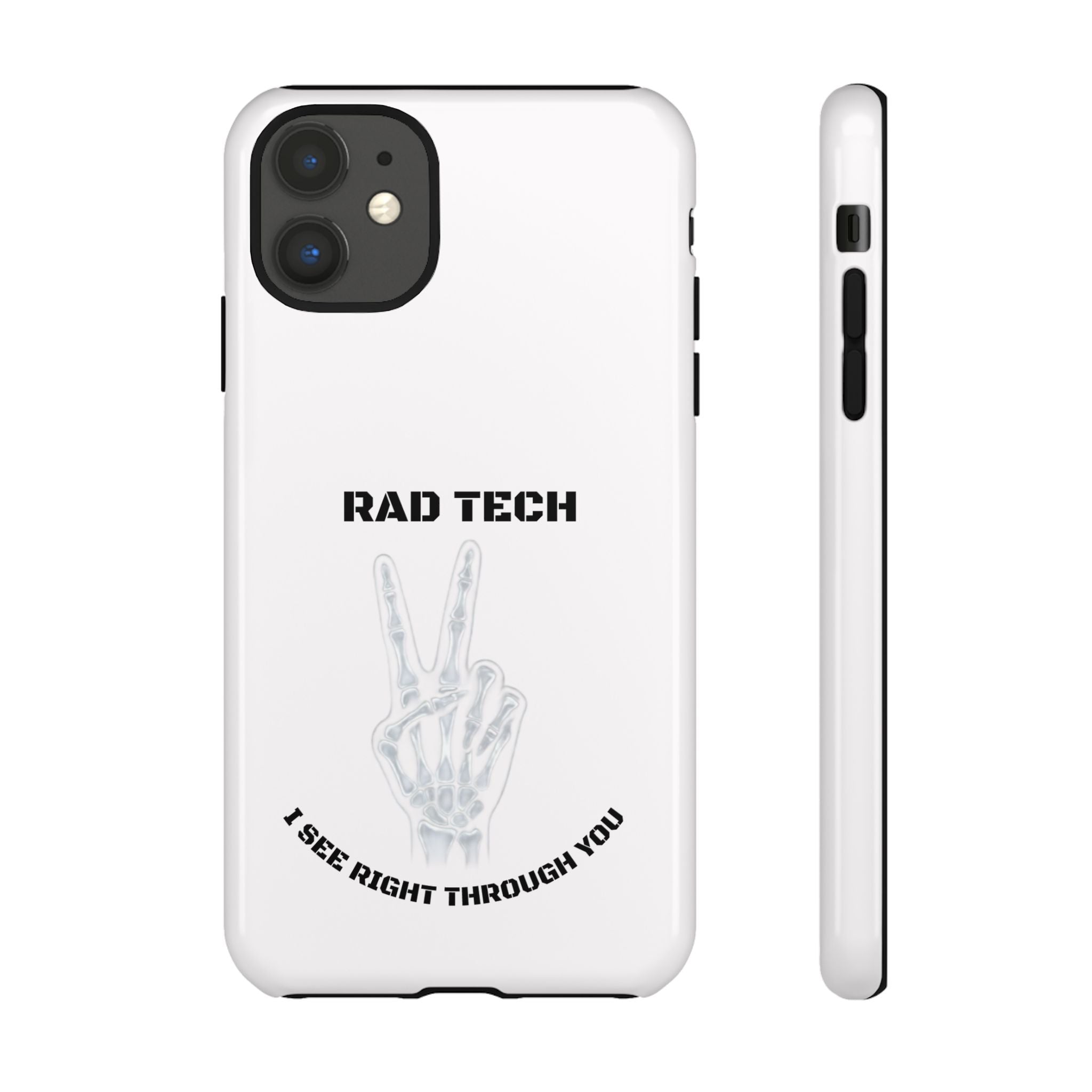Rad Tech Phone Case — Skeleton Hand "I See Right Through You" X-ray Technician Gift