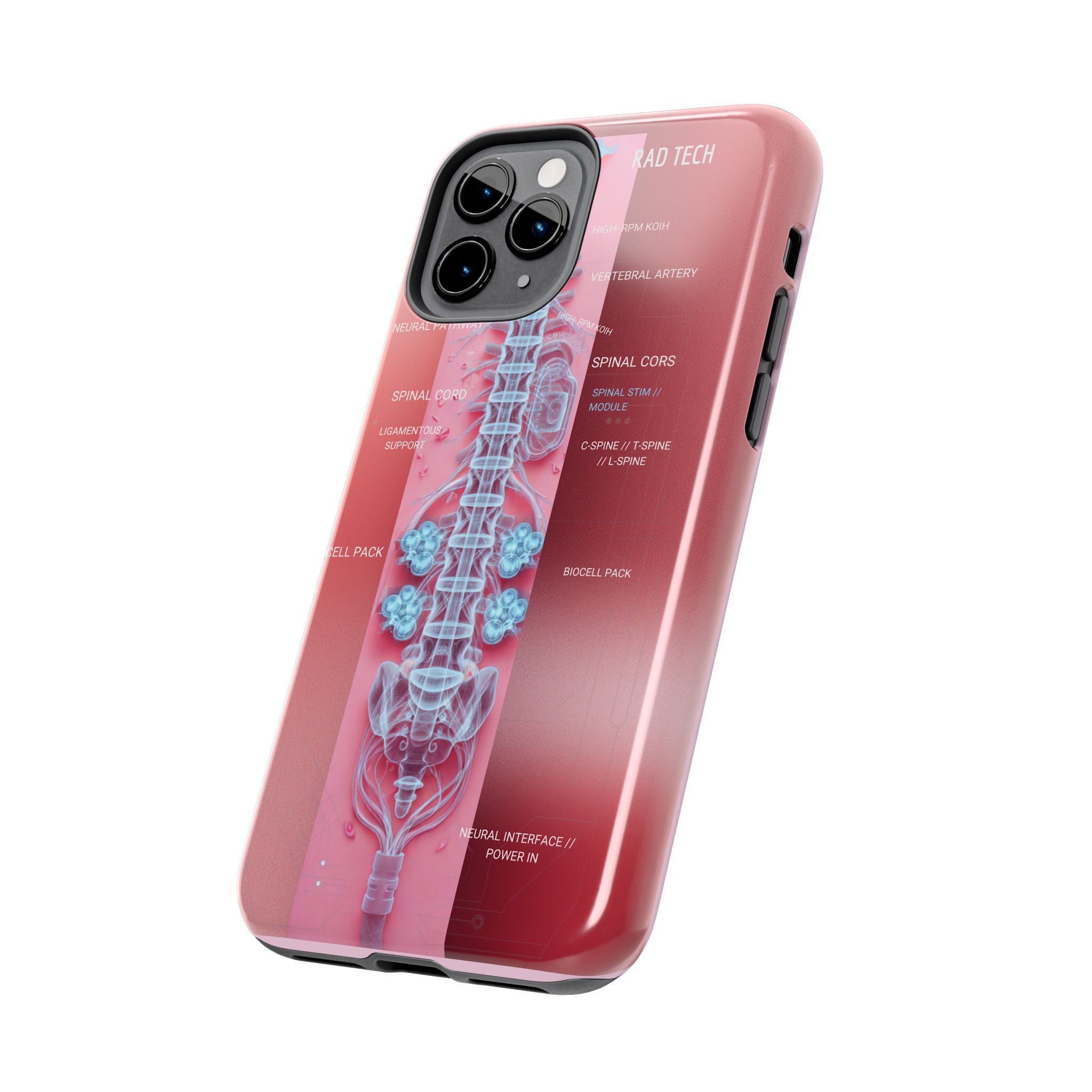 Anatomical Spine Tough Phone Case — Medical X-Ray Design, ‘Spinal Cord’ Labelled