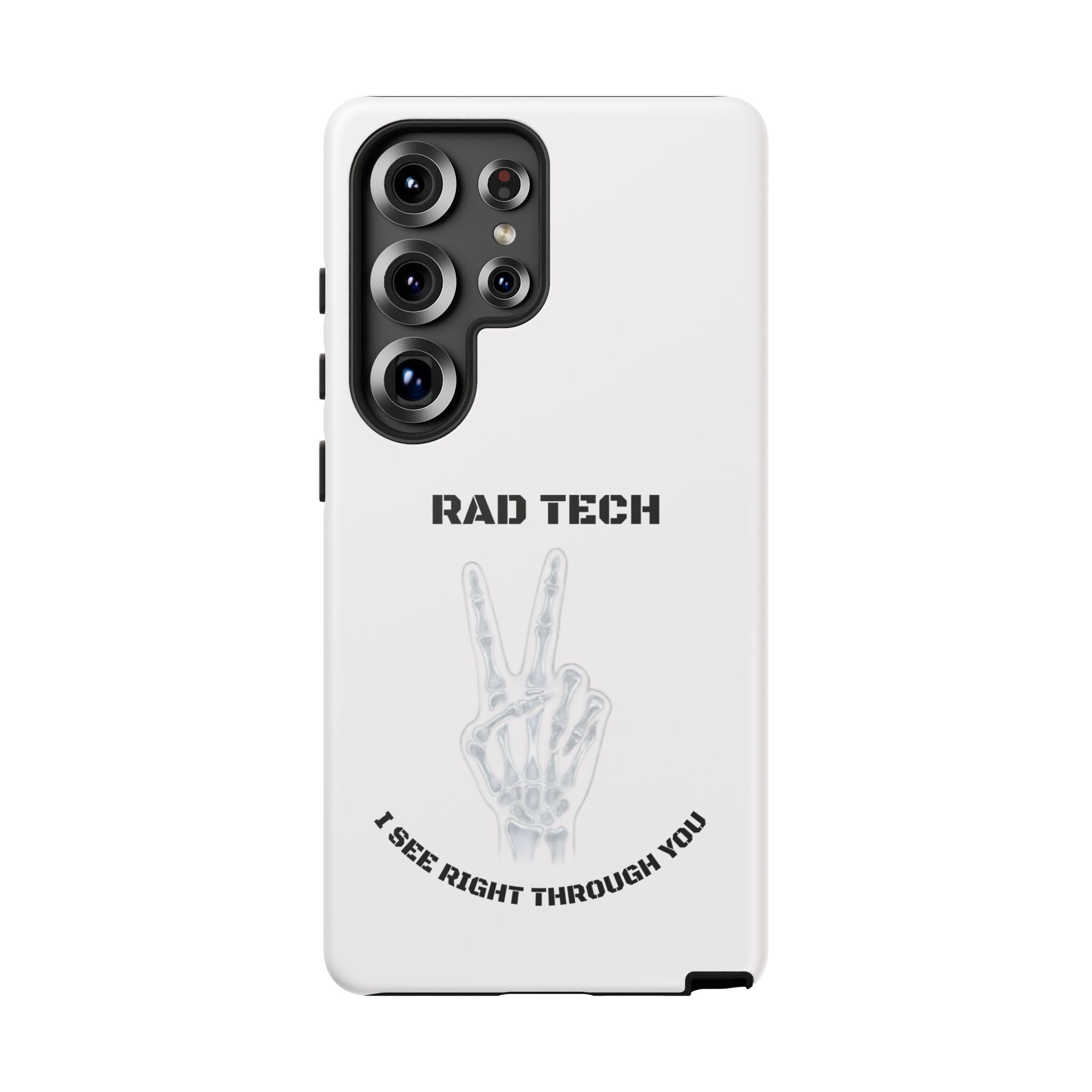 Rad Tech Phone Case — Skeleton Hand "I See Right Through You" X-ray Technician Gift