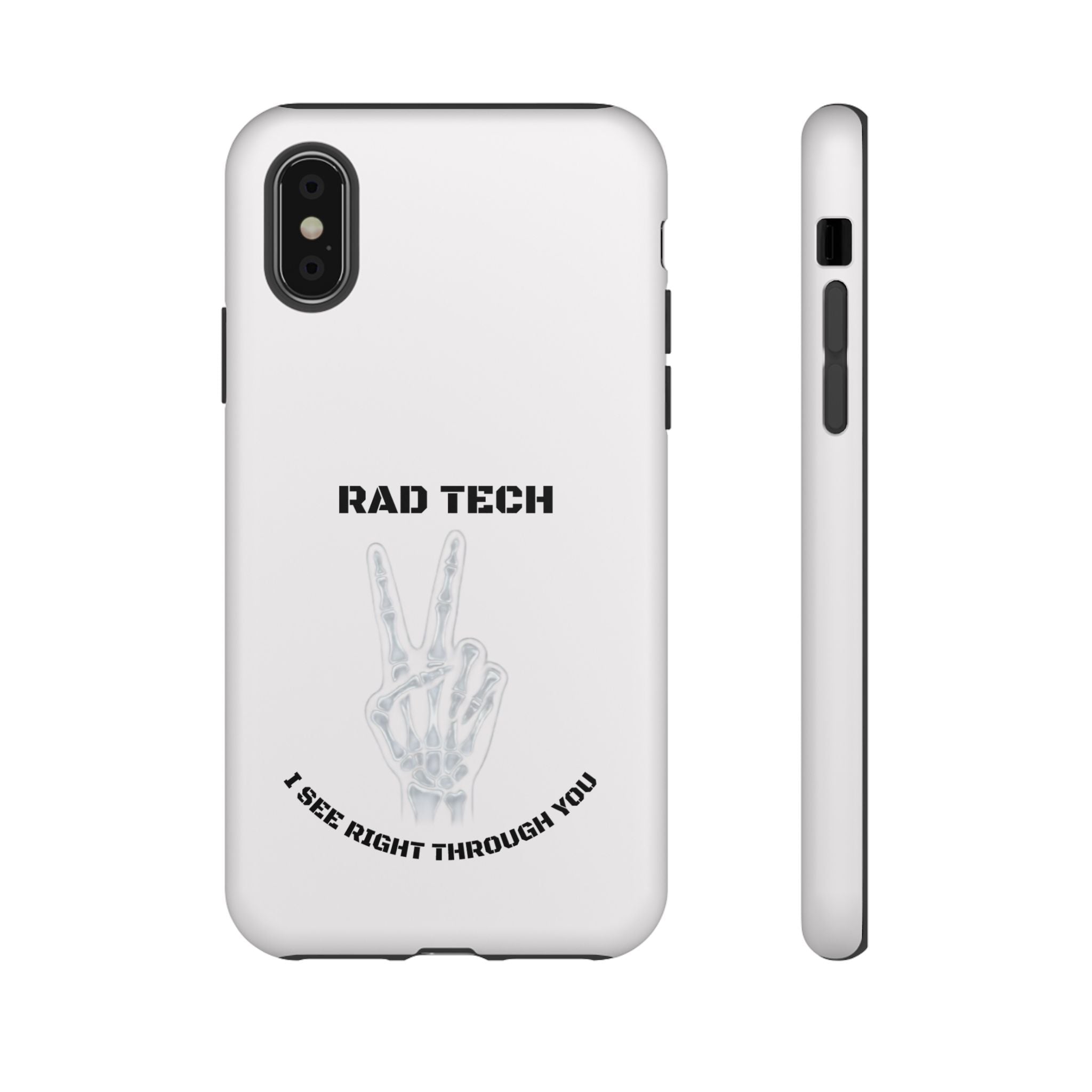Rad Tech Phone Case — Skeleton Hand "I See Right Through You" X-ray Technician Gift