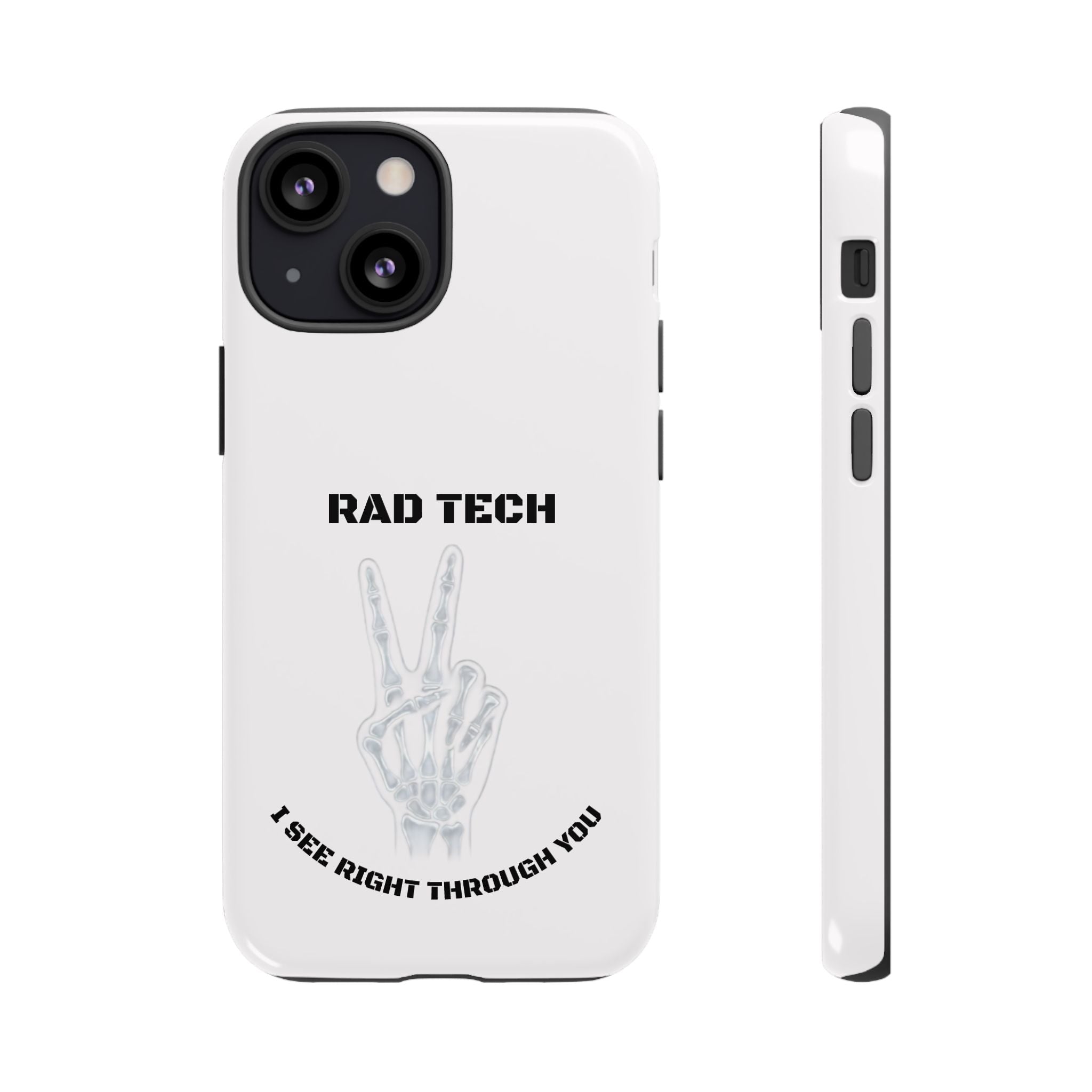 Rad Tech Phone Case — Skeleton Hand "I See Right Through You" X-ray Technician Gift