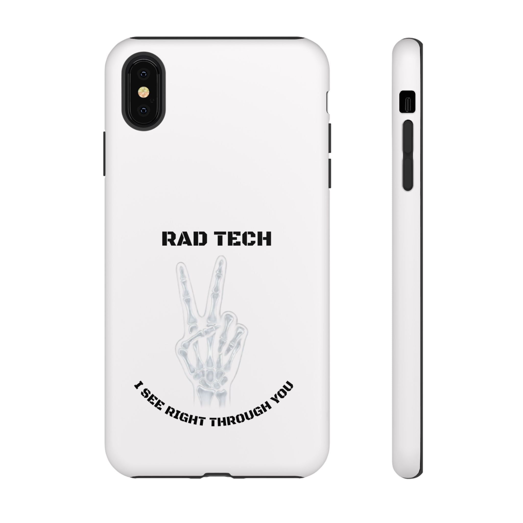 Rad Tech Phone Case — Skeleton Hand "I See Right Through You" X-ray Technician Gift