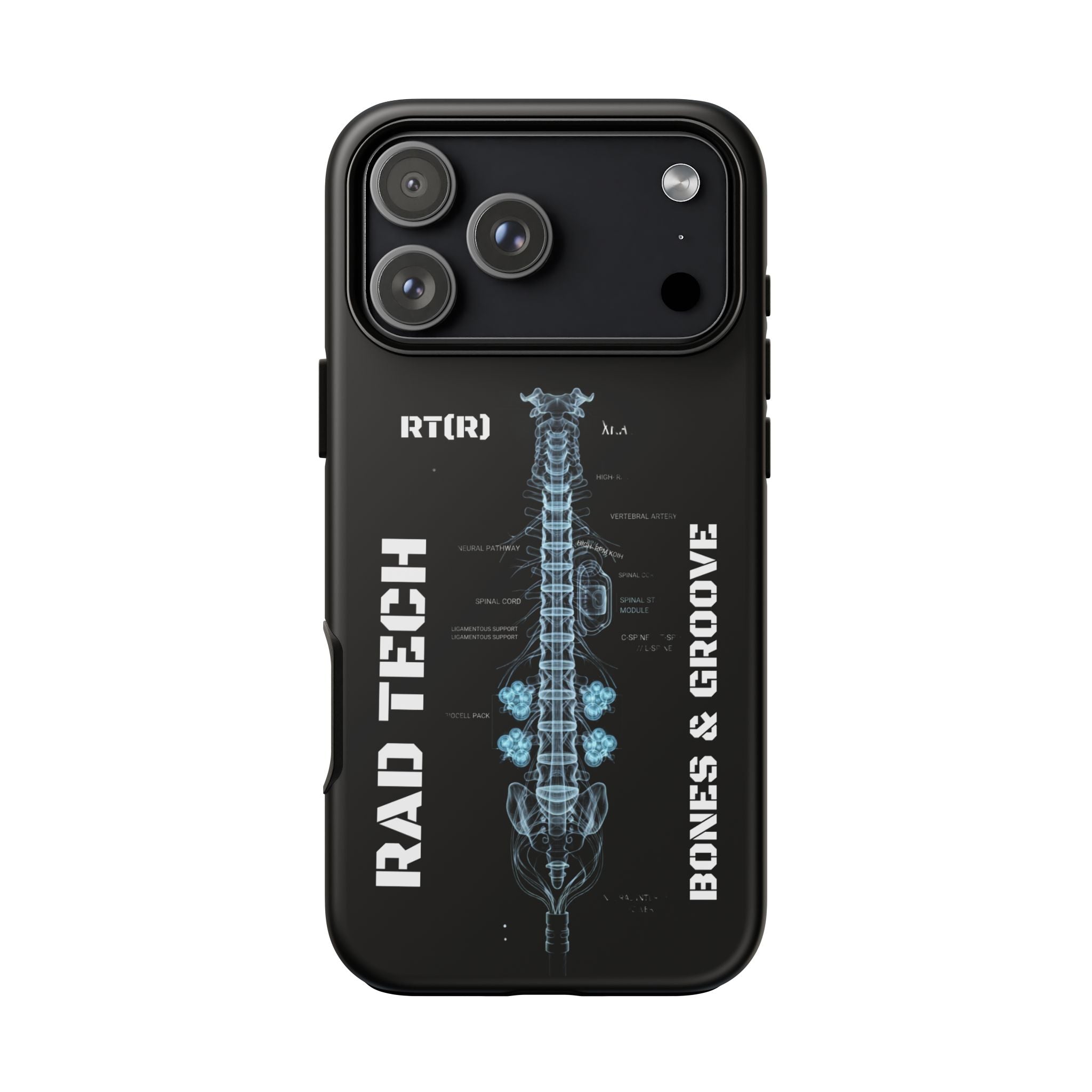 RAD TECH -Aesthetic Phone Case