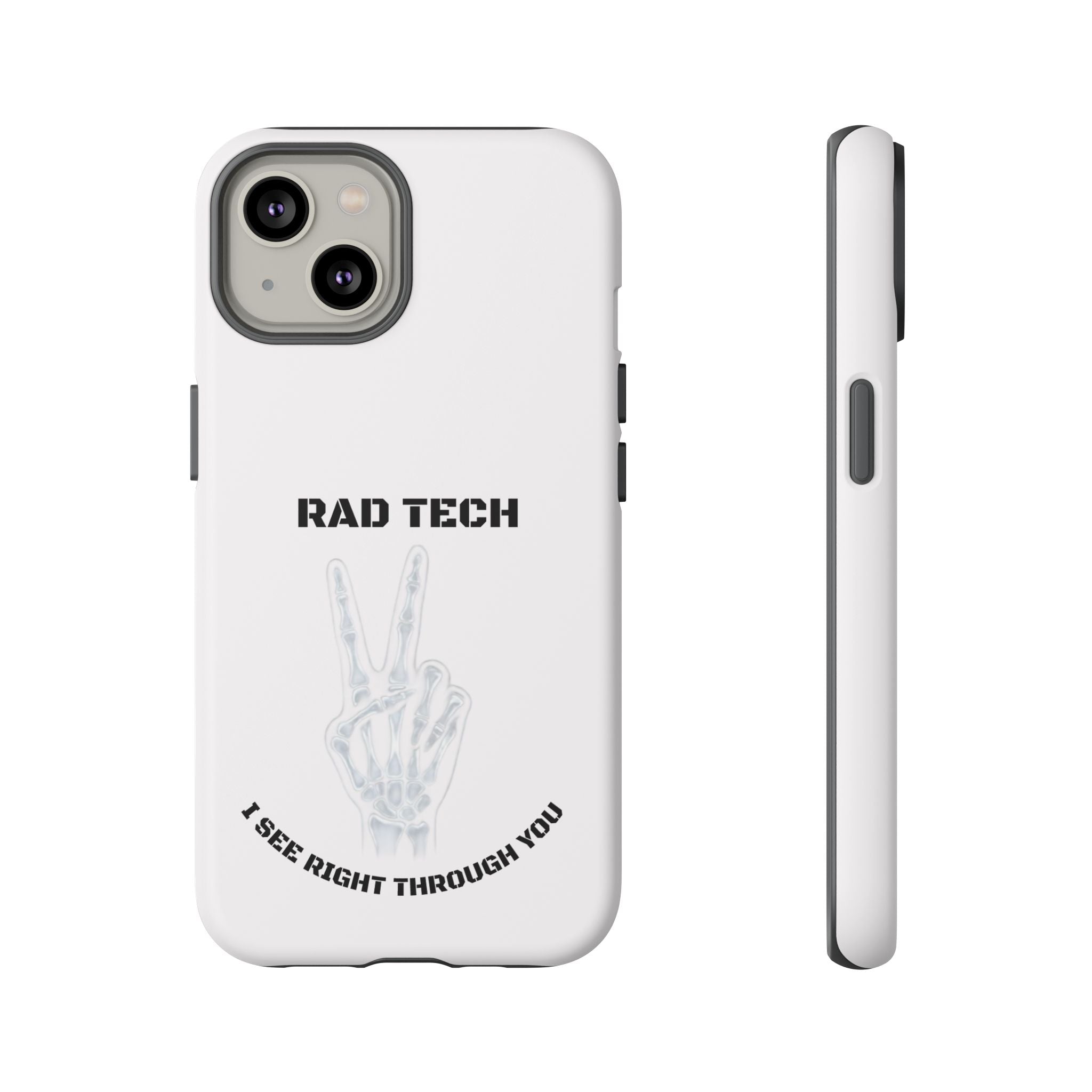 Rad Tech Phone Case — Skeleton Hand "I See Right Through You" X-ray Technician Gift
