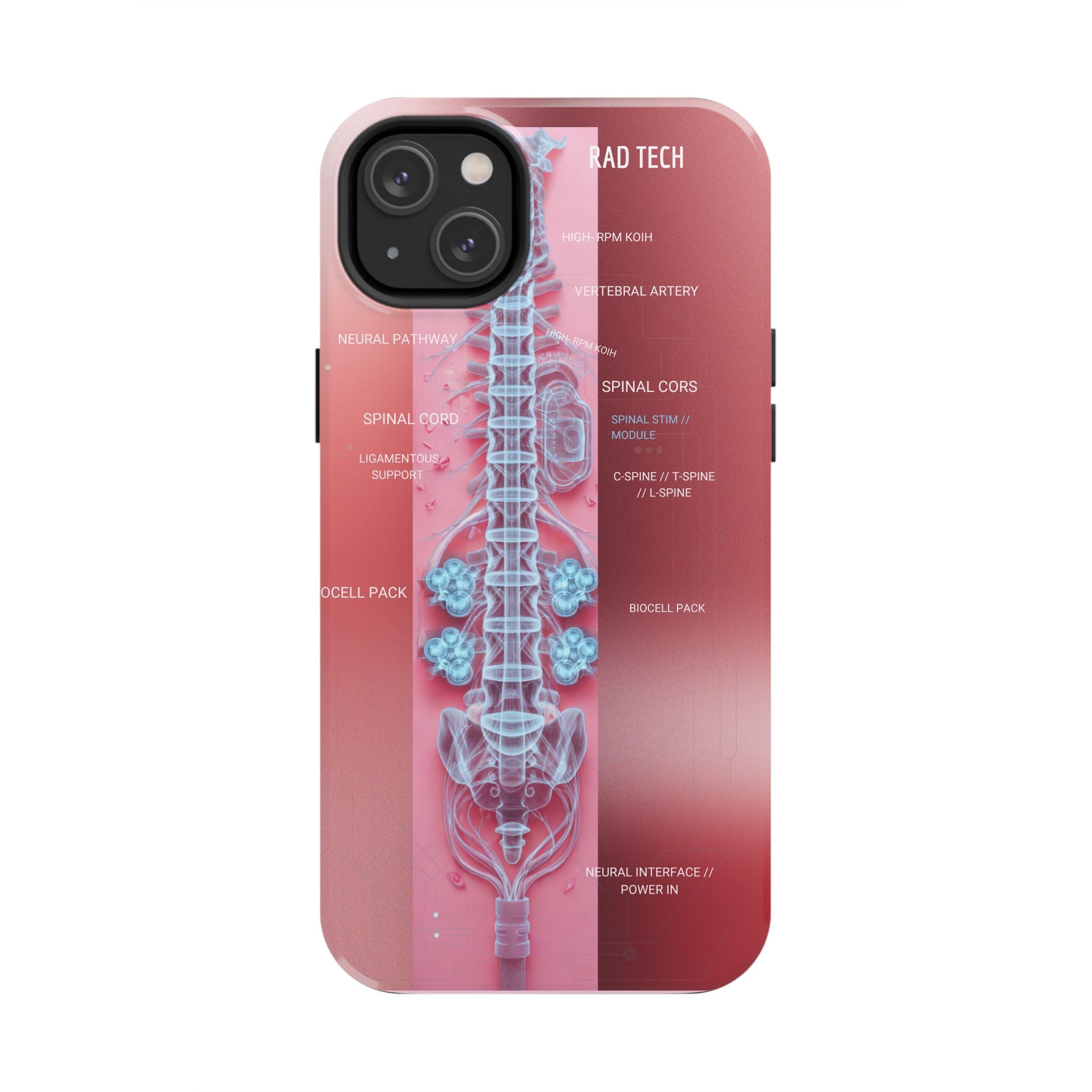 Anatomical Spine Tough Phone Case — Medical X-Ray Design, ‘Spinal Cord’ Labelled