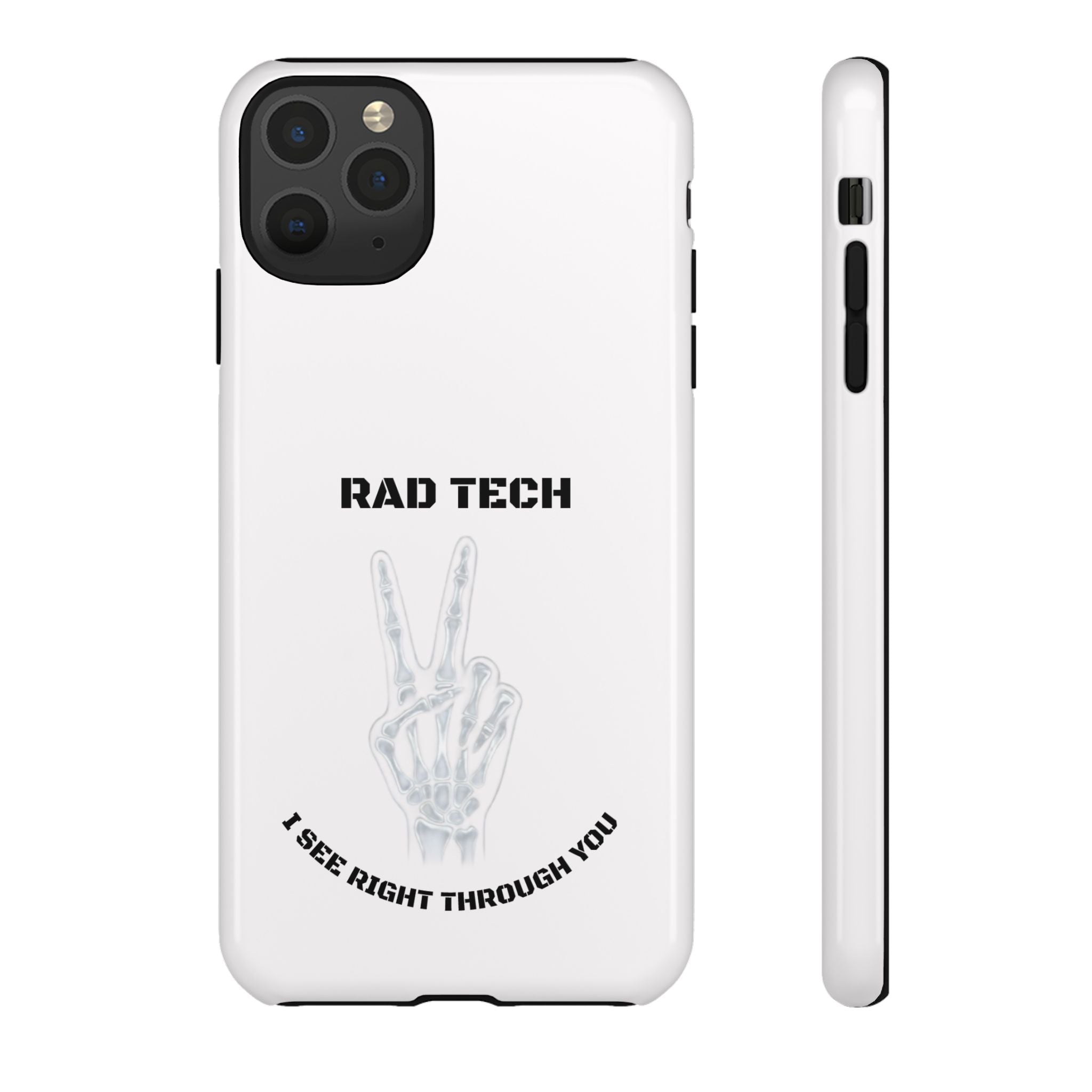 Rad Tech Phone Case — Skeleton Hand "I See Right Through You" X-ray Technician Gift