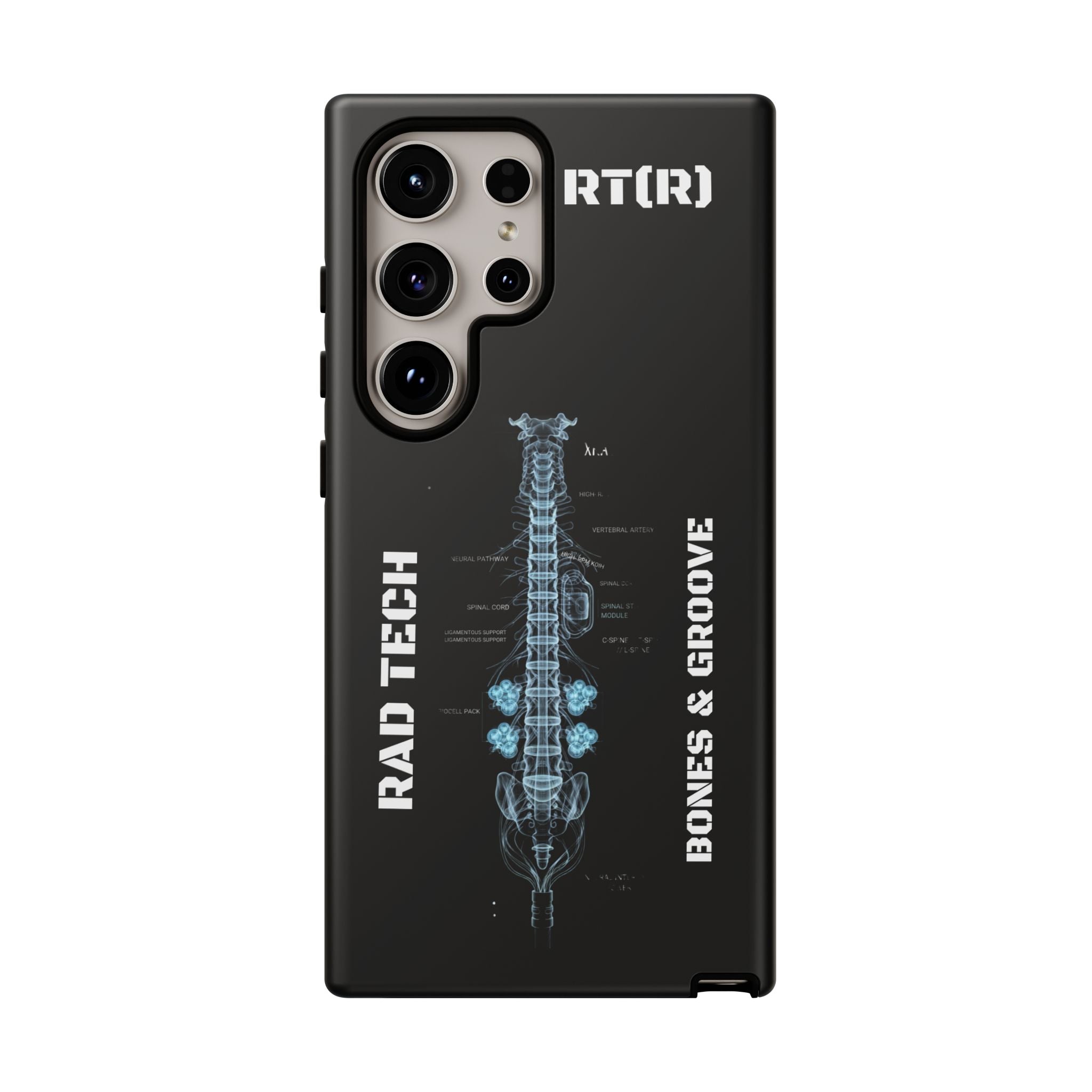 RAD TECH -Aesthetic Phone Case