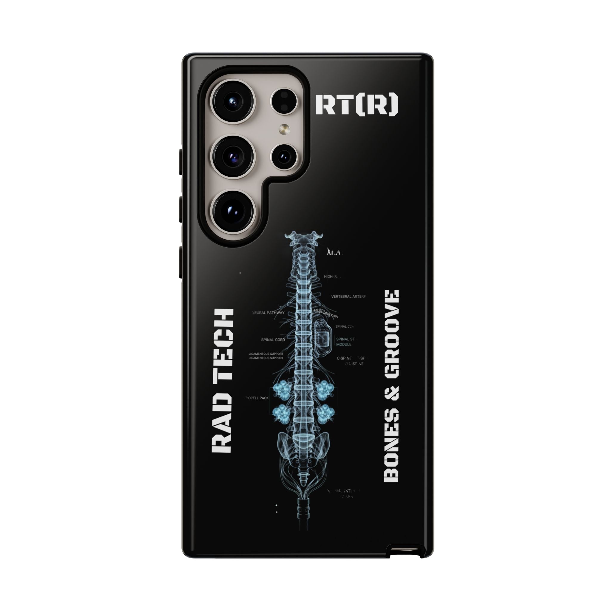 RAD TECH -Aesthetic Phone Case
