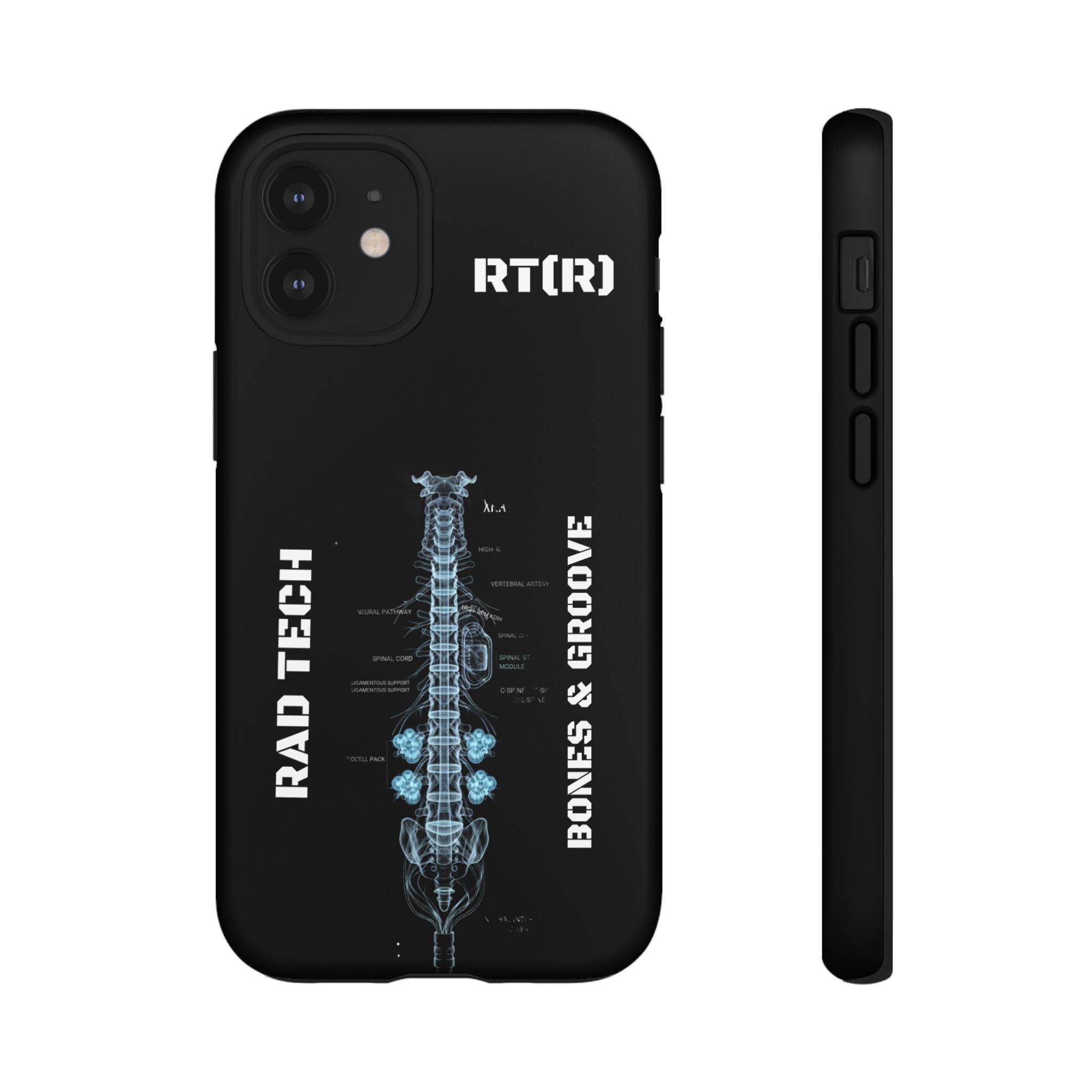 RAD TECH -Aesthetic Phone Case
