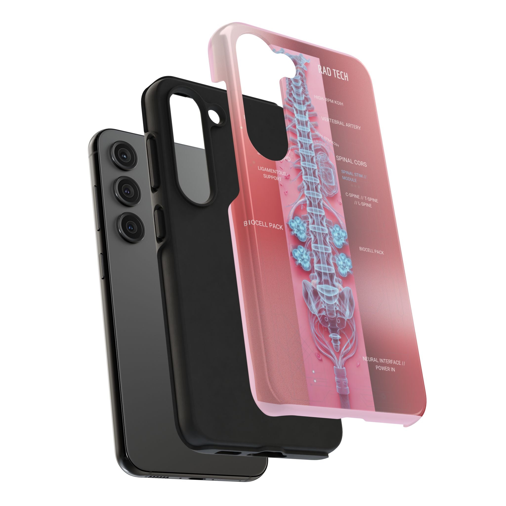 Anatomical Spine Tough Phone Case — Medical X-Ray Design, ‘Spinal Cord’ Labelled