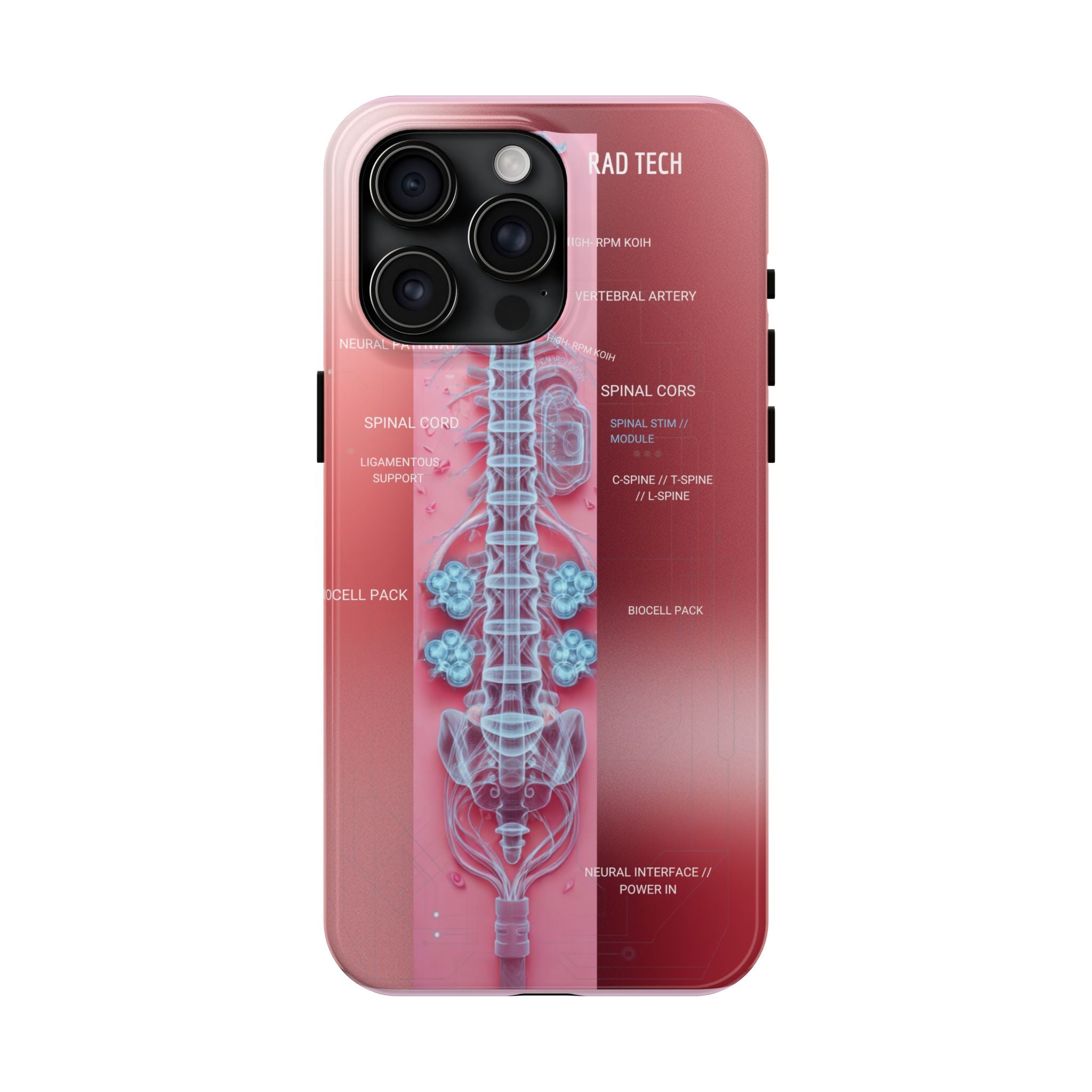 Anatomical Spine Tough Phone Case — Medical X-Ray Design, ‘Spinal Cord’ Labelled
