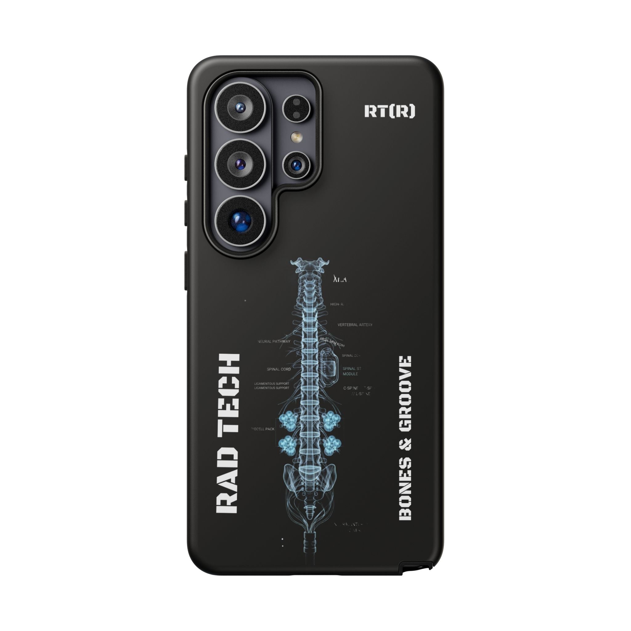 RAD TECH -Aesthetic Phone Case