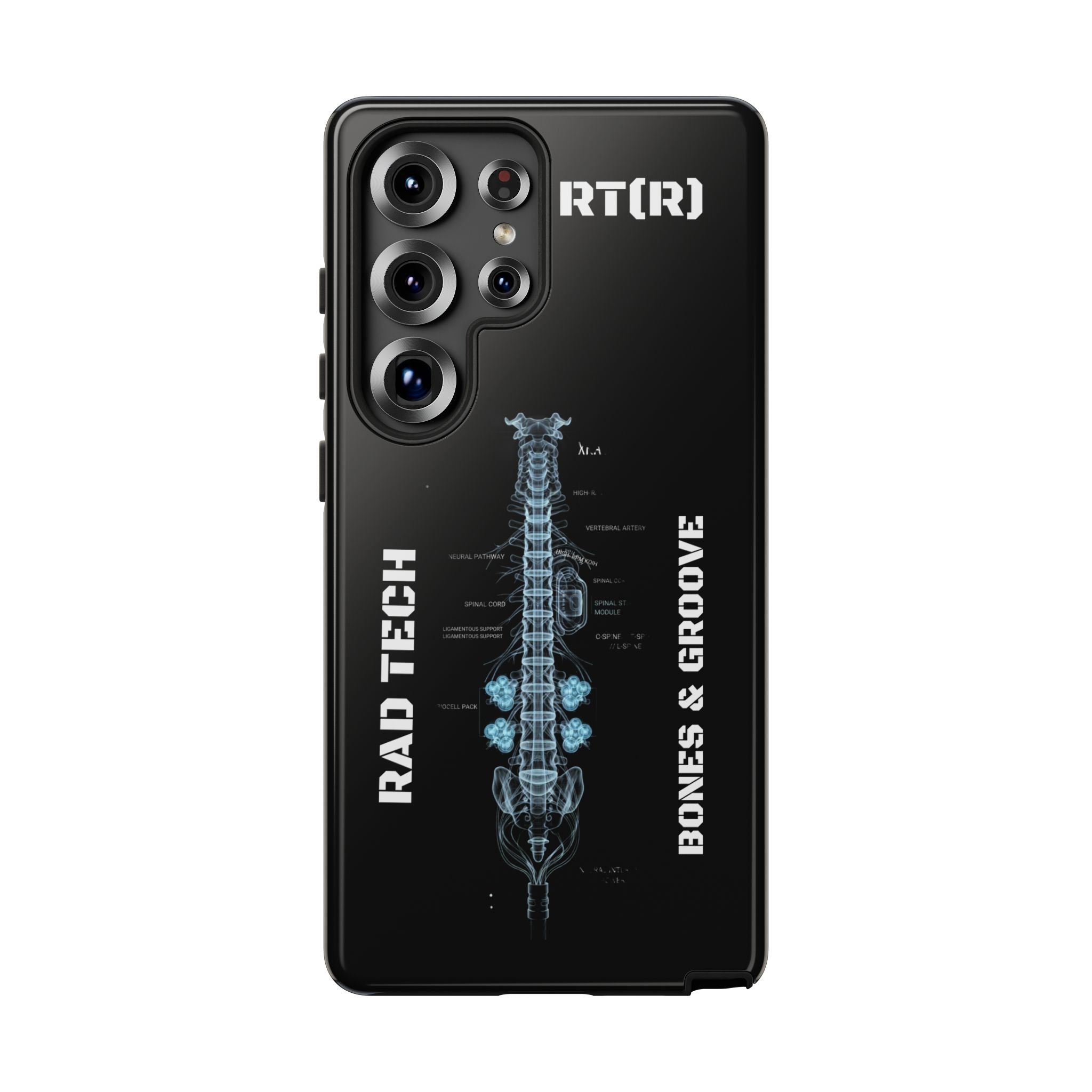 RAD TECH -Aesthetic Phone Case