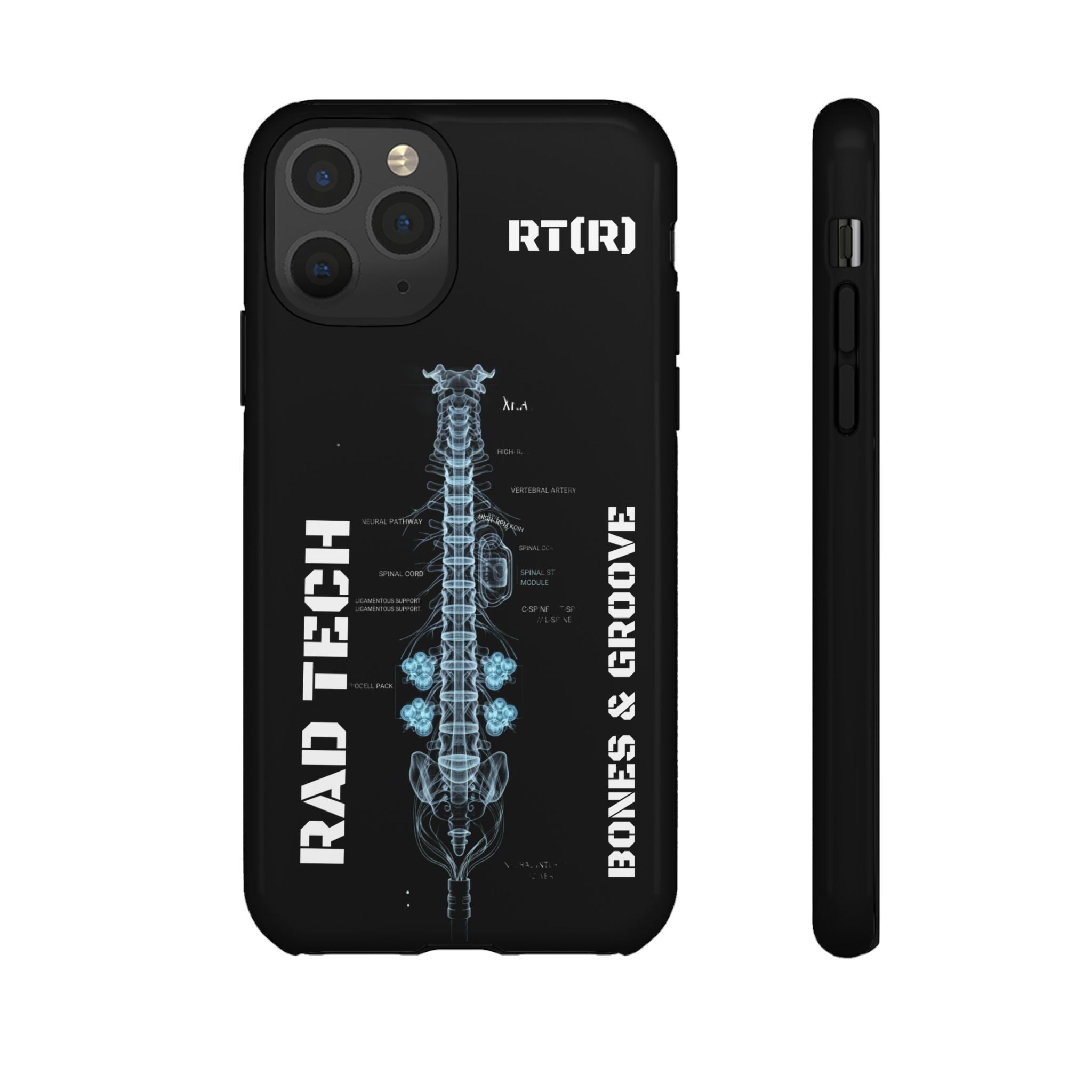 RAD TECH -Aesthetic Phone Case