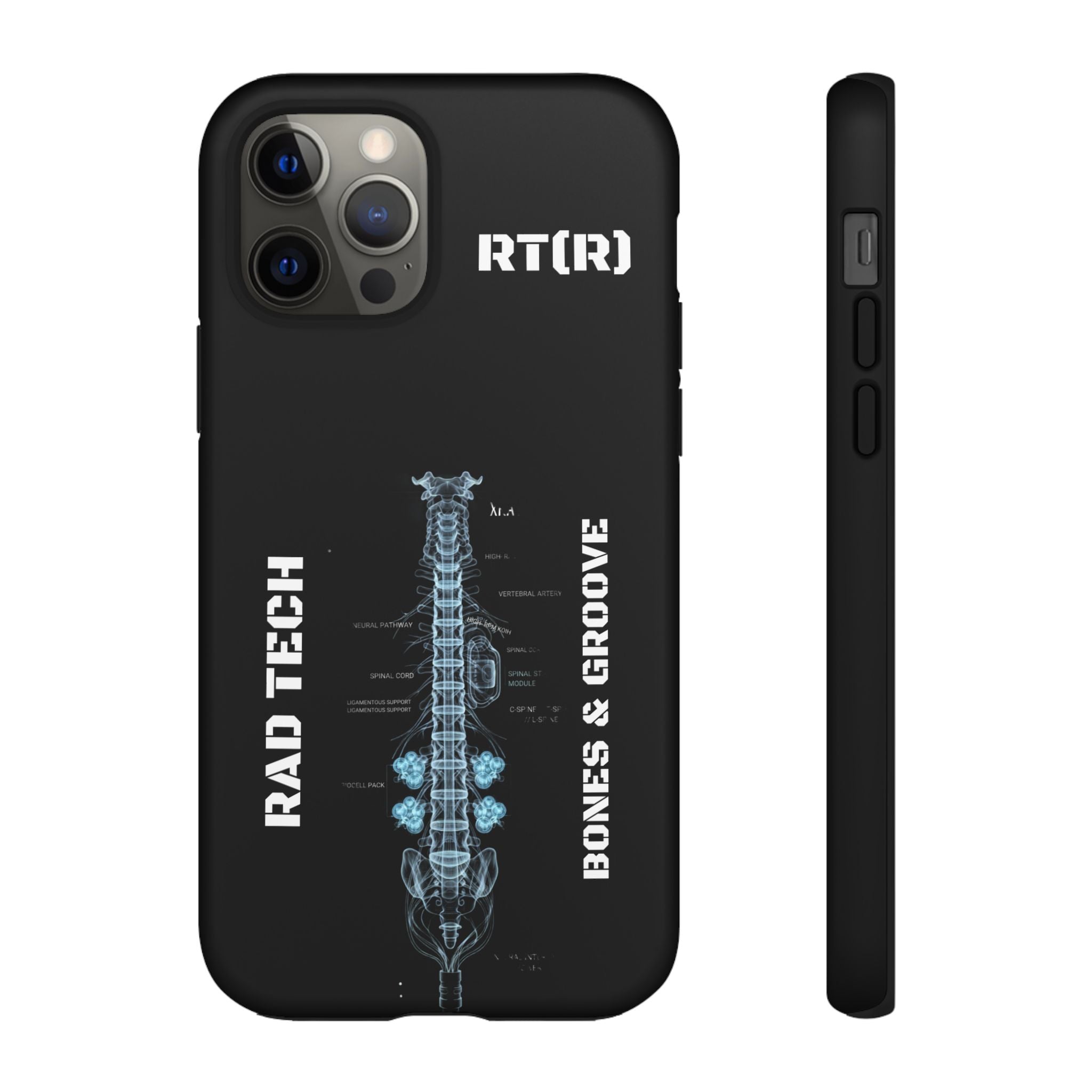 RAD TECH -Aesthetic Phone Case