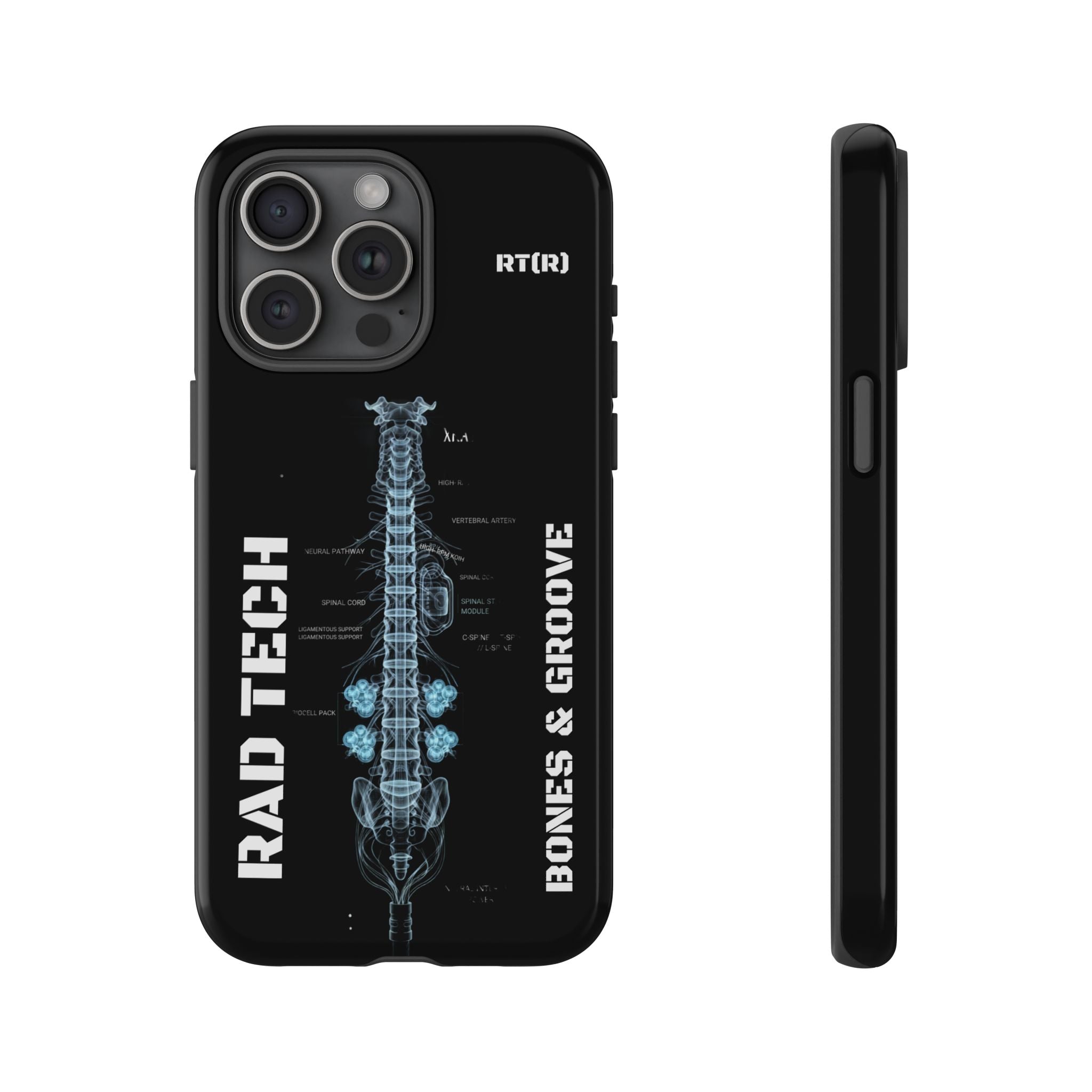 RAD TECH -Aesthetic Phone Case