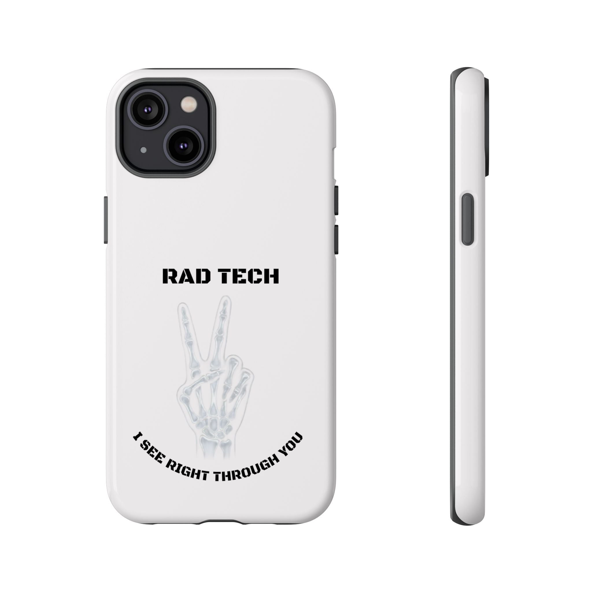 Rad Tech Phone Case — Skeleton Hand "I See Right Through You" X-ray Technician Gift