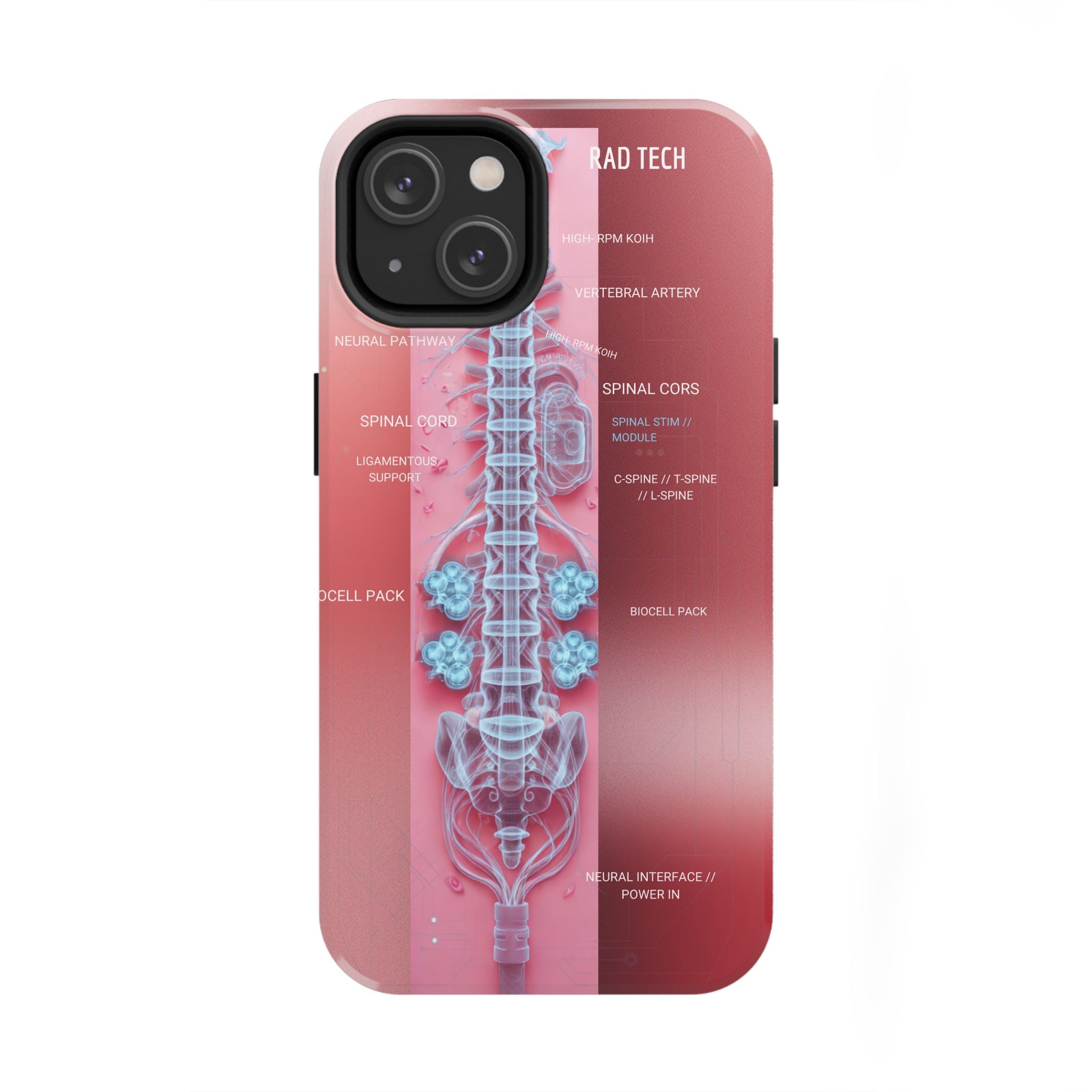 Anatomical Spine Tough Phone Case — Medical X-Ray Design, ‘Spinal Cord’ Labelled