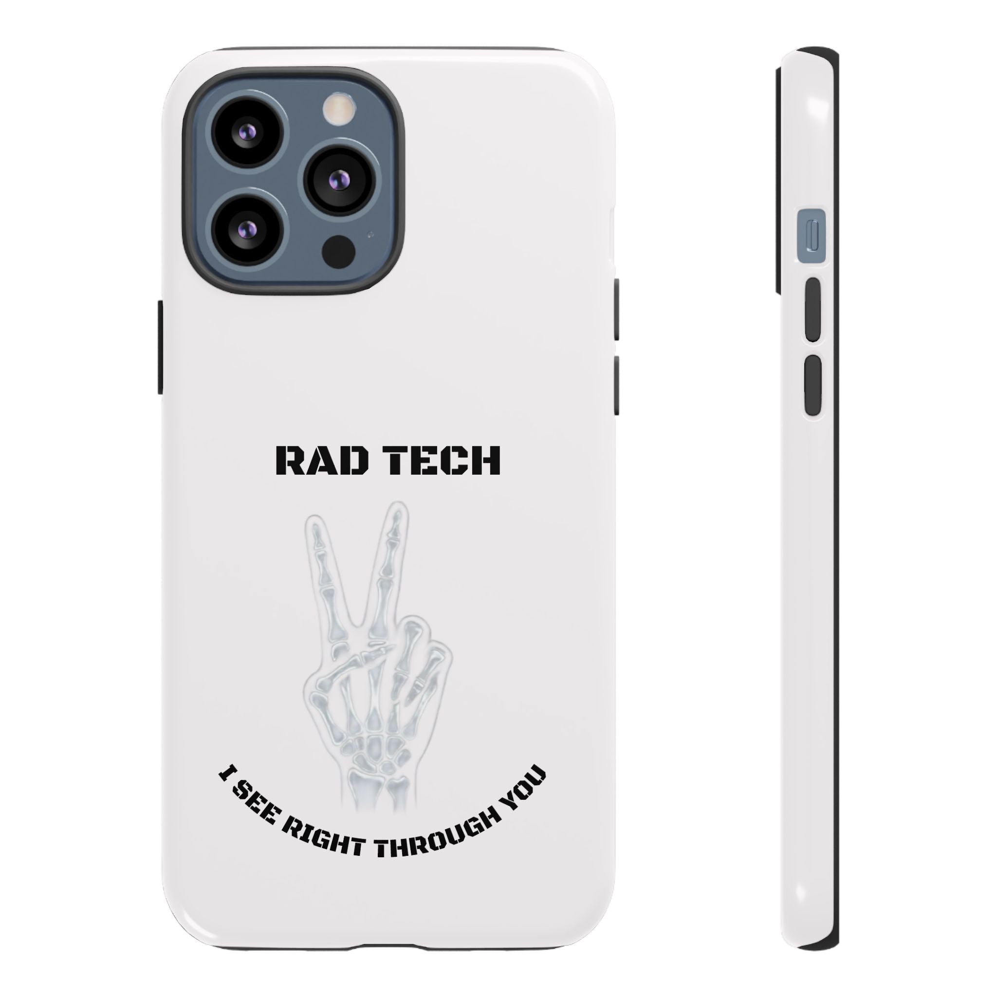 Rad Tech Phone Case — Skeleton Hand "I See Right Through You" X-ray Technician Gift