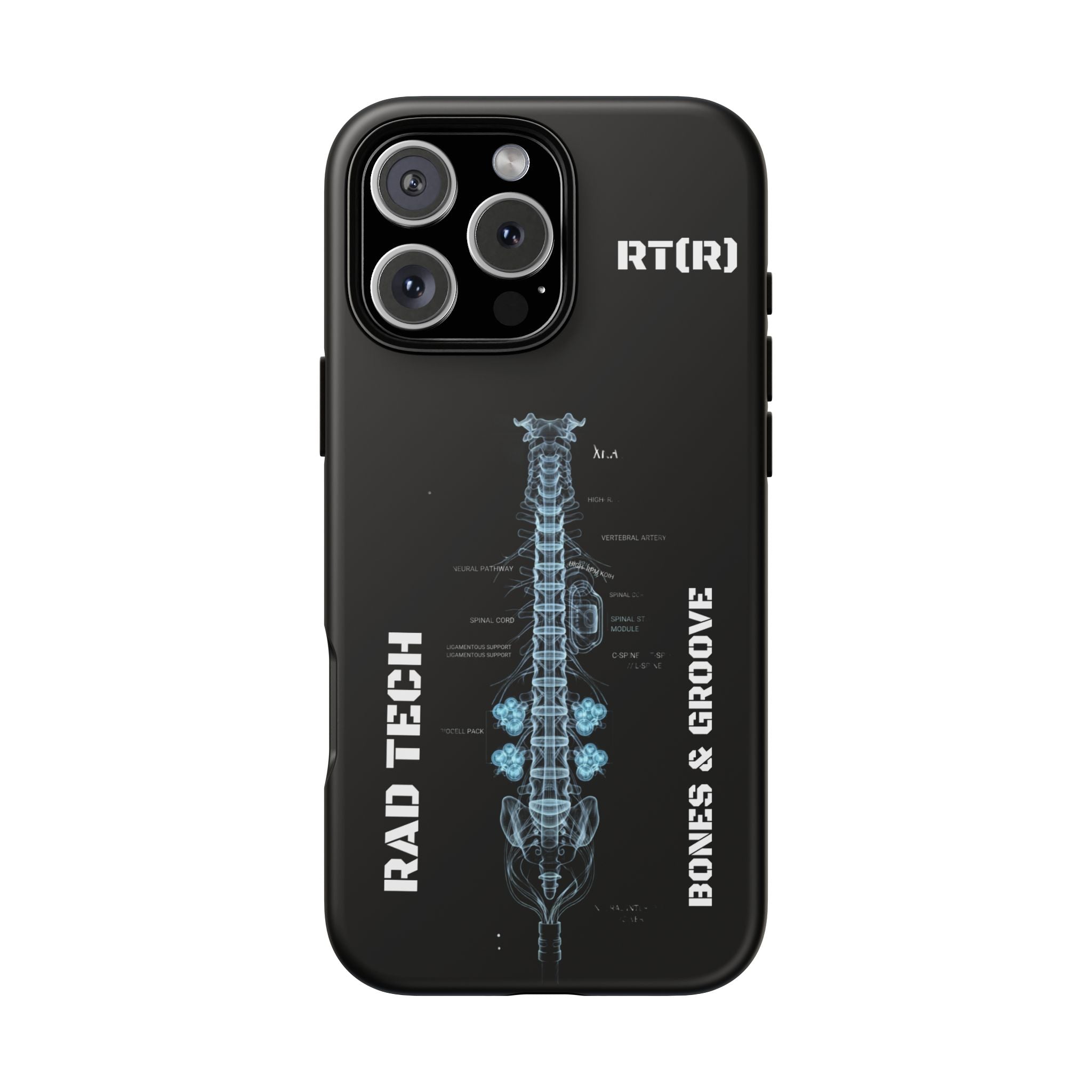 RAD TECH -Aesthetic Phone Case