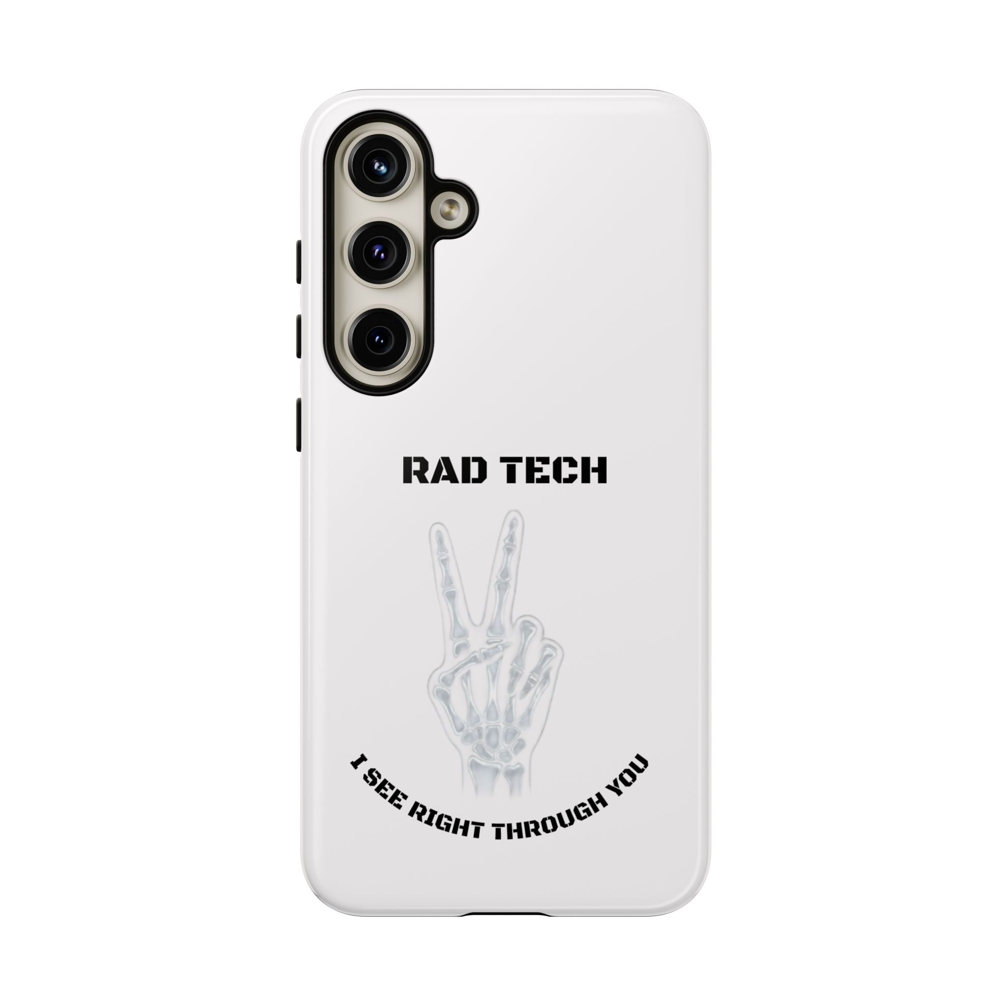 Rad Tech Phone Case — Skeleton Hand "I See Right Through You" X-ray Technician Gift