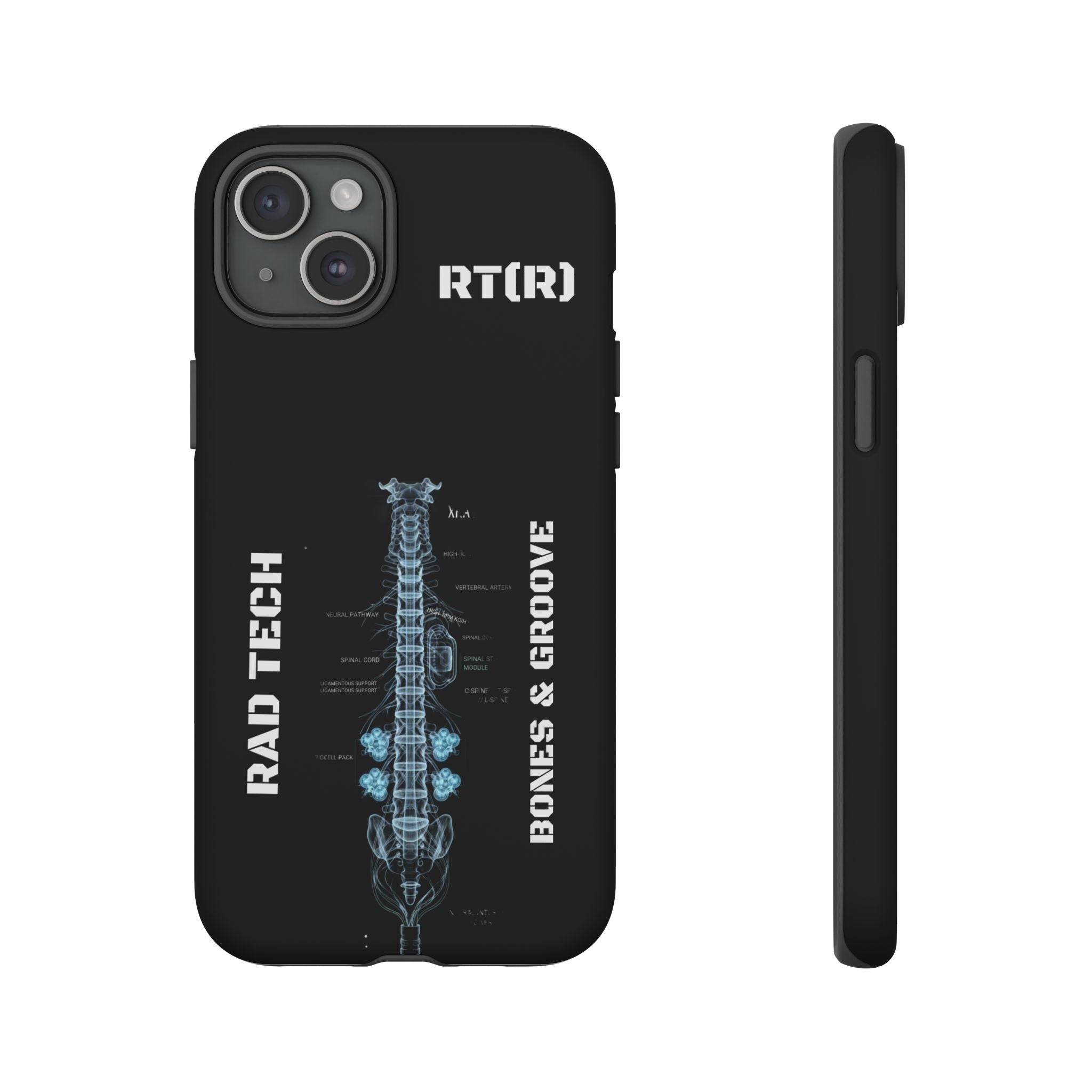 RAD TECH -Aesthetic Phone Case