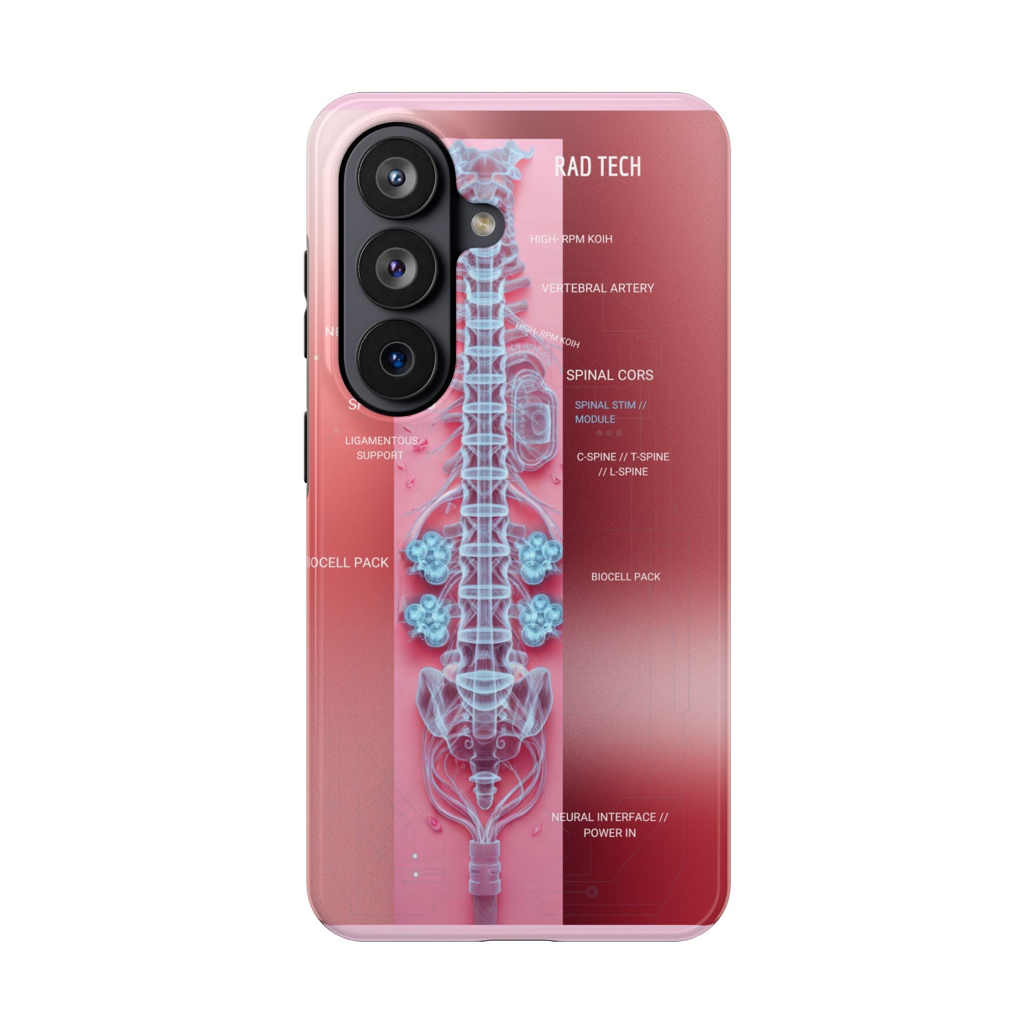 Anatomical Spine Tough Phone Case — Medical X-Ray Design, ‘Spinal Cord’ Labelled