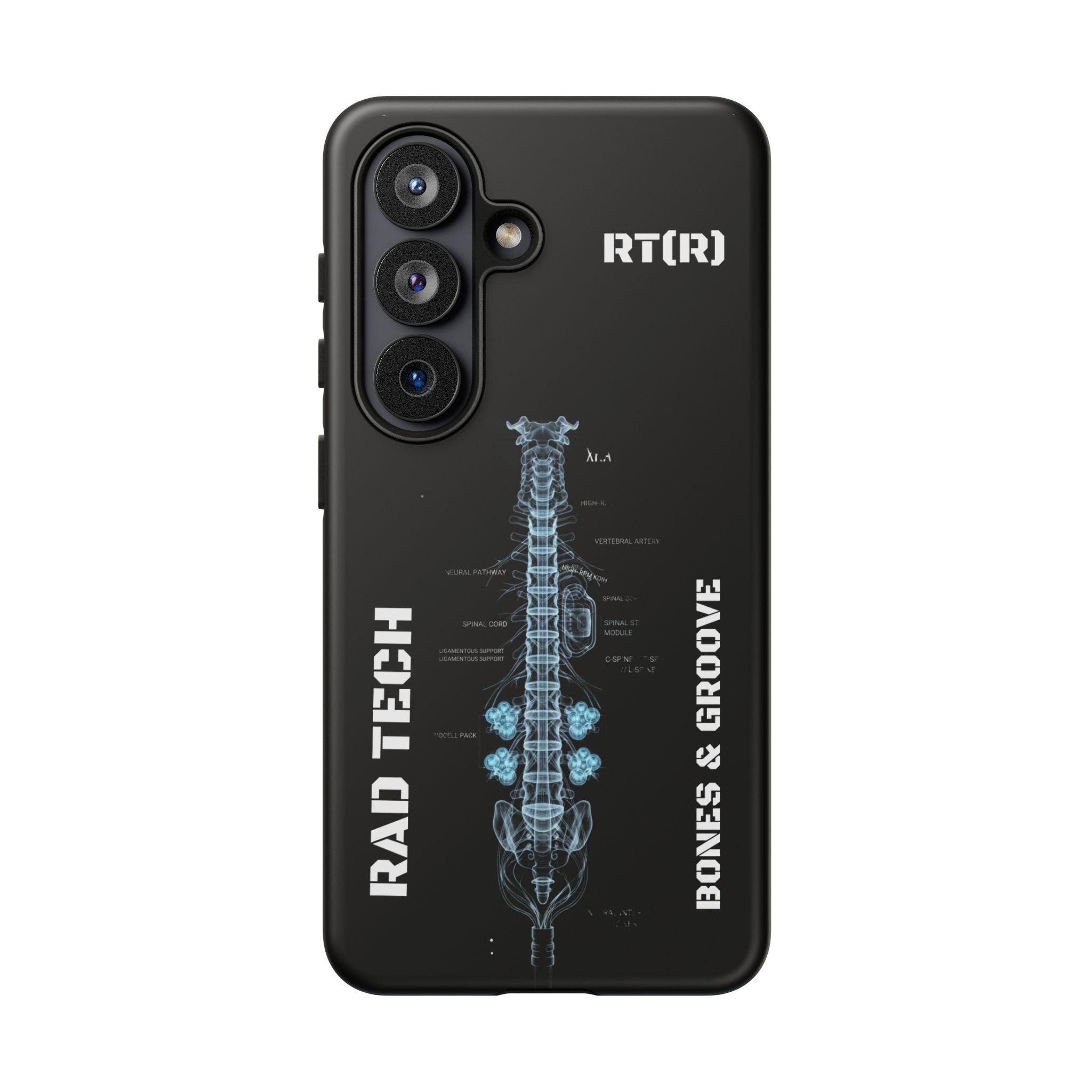 RAD TECH -Aesthetic Phone Case