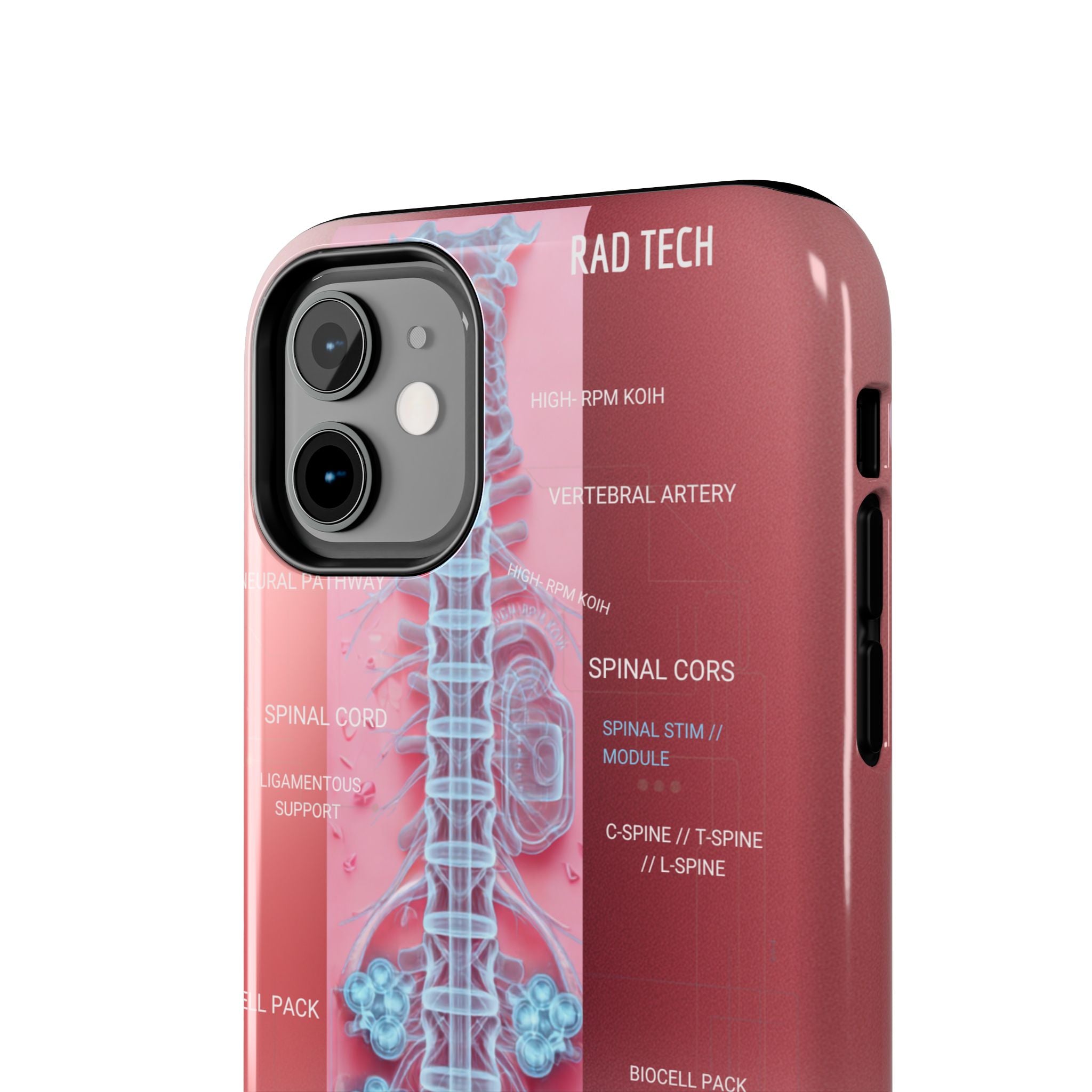 Anatomical Spine Tough Phone Case — Medical X-Ray Design, ‘Spinal Cord’ Labelled