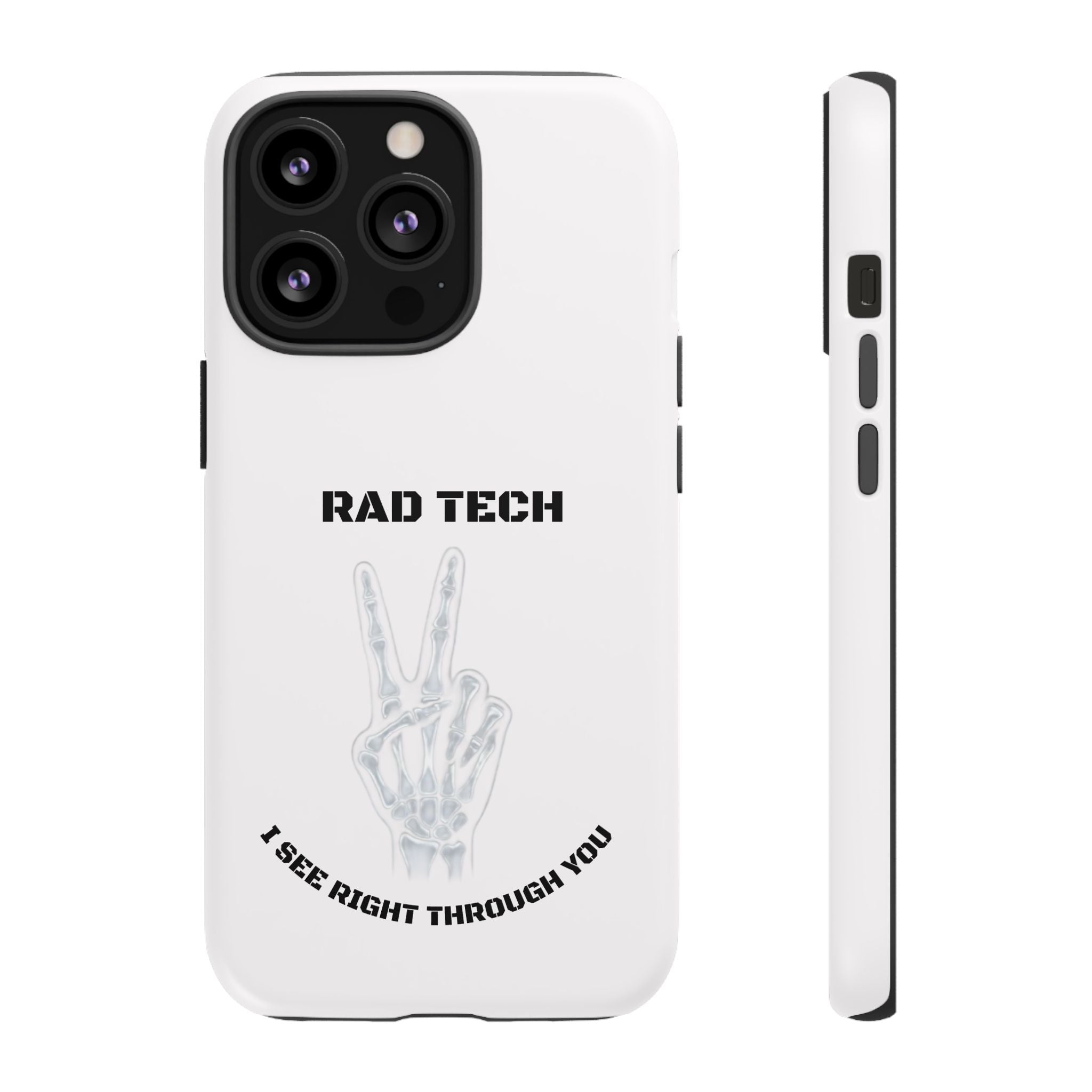 Rad Tech Phone Case — Skeleton Hand "I See Right Through You" X-ray Technician Gift