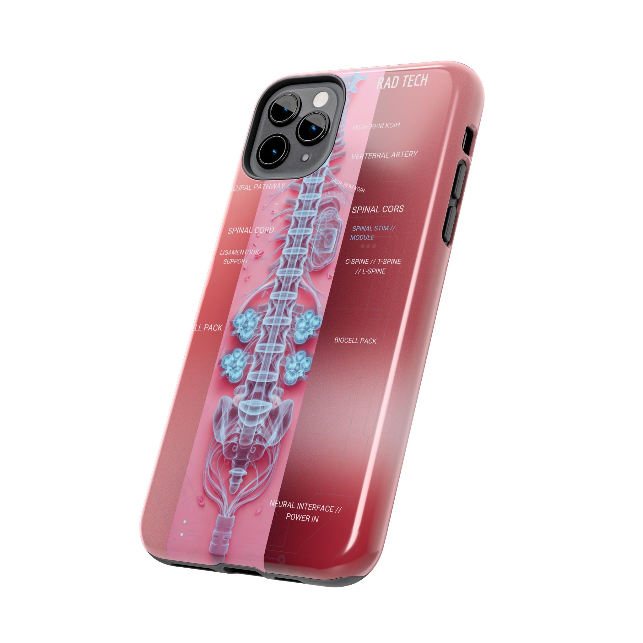 Anatomical Spine Tough Phone Case — Medical X-Ray Design, ‘Spinal Cord’ Labelled