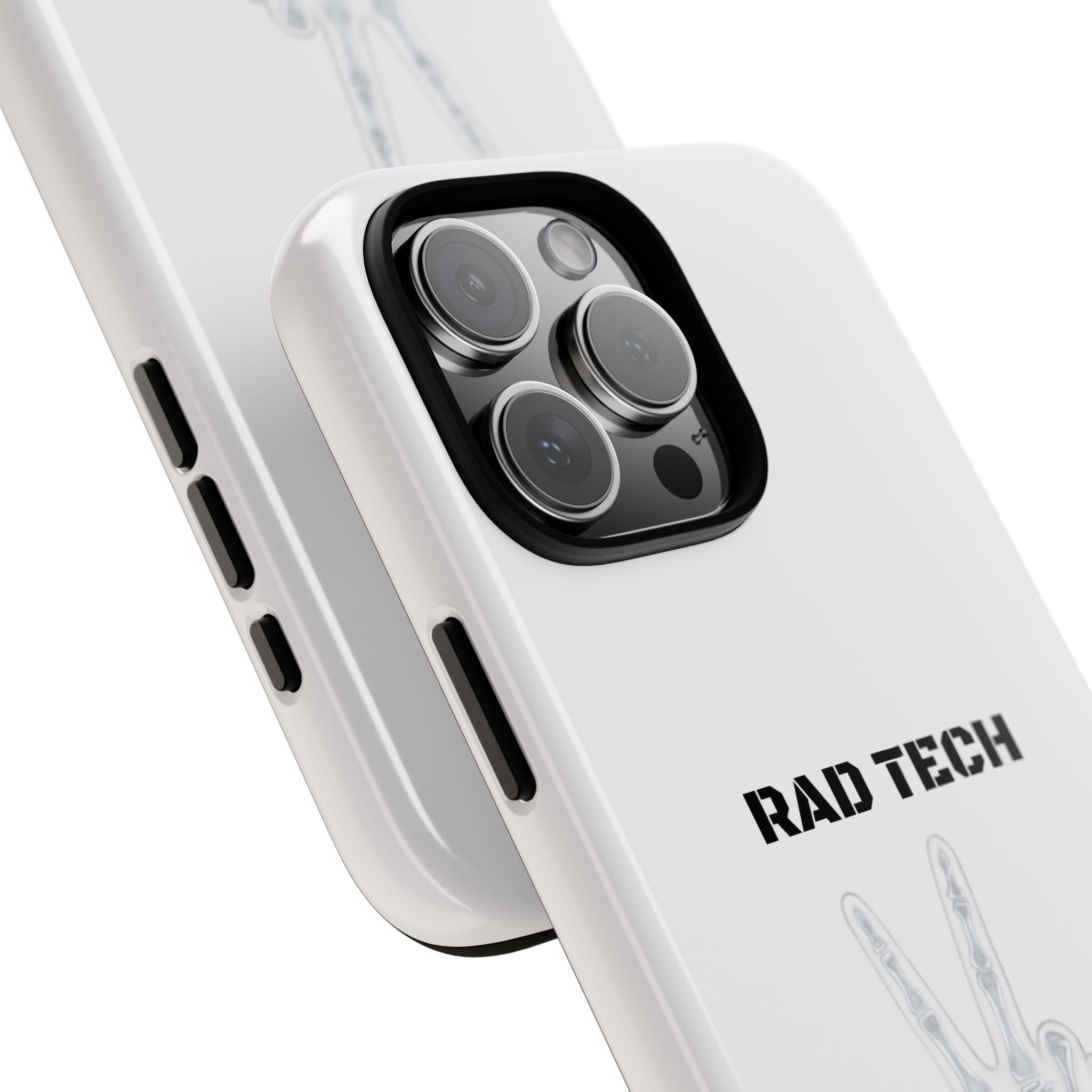 Rad Tech Phone Case — Skeleton Hand "I See Right Through You" X-ray Technician Gift