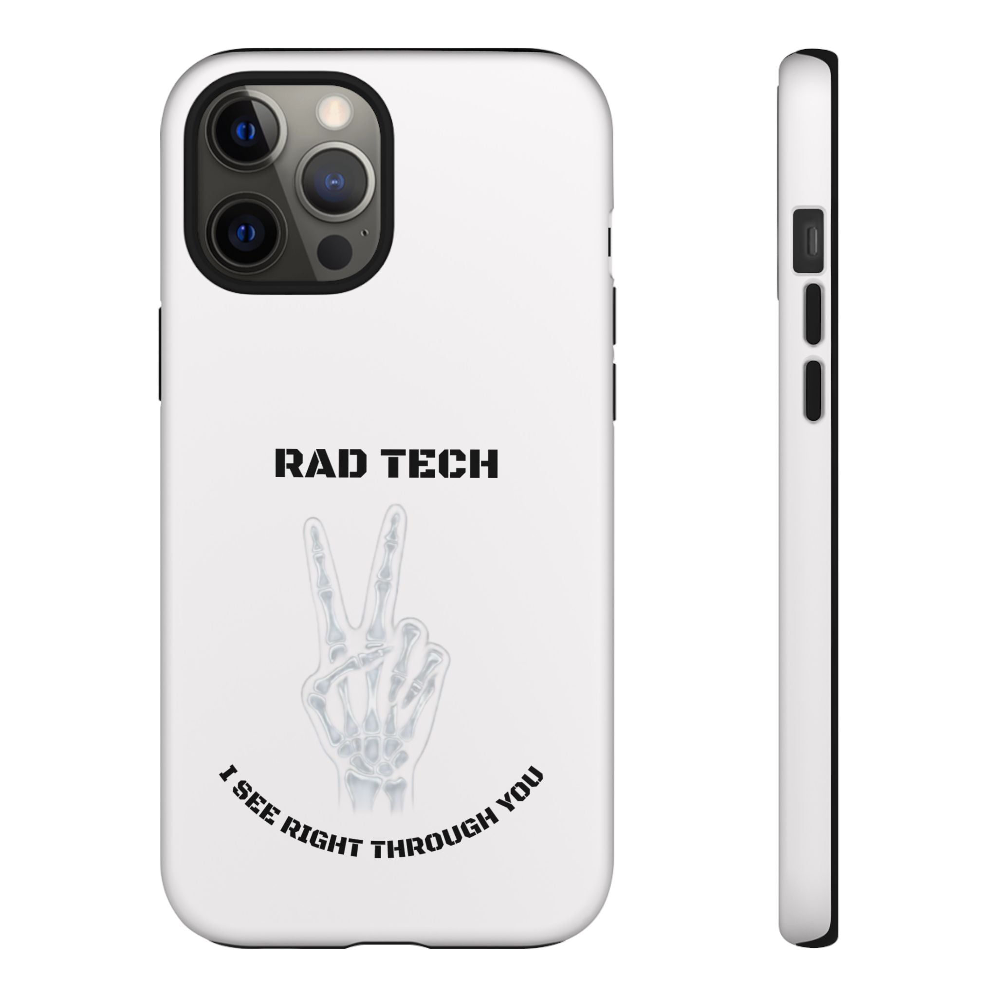 Rad Tech Phone Case — Skeleton Hand "I See Right Through You" X-ray Technician Gift