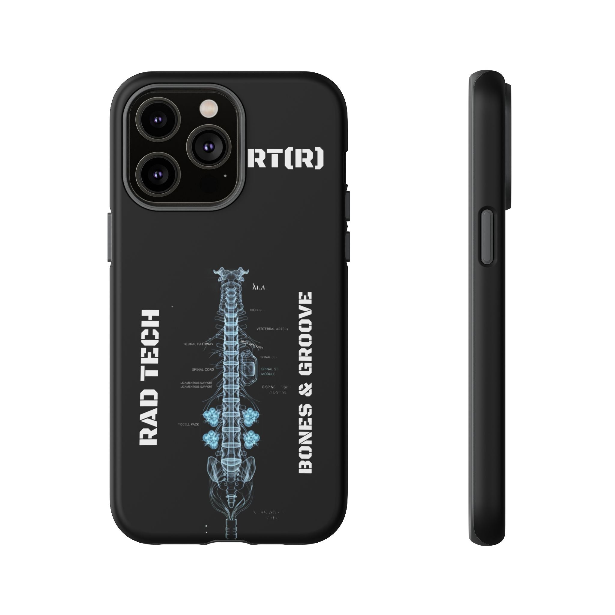 RAD TECH -Aesthetic Phone Case