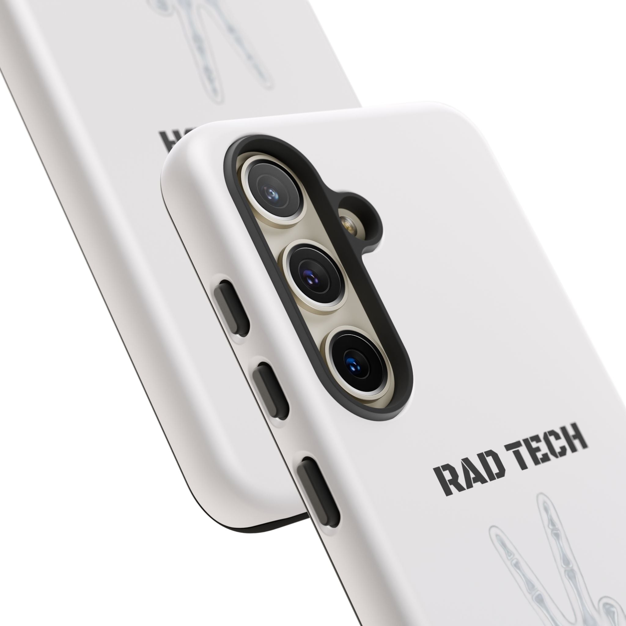 Rad Tech Phone Case — Skeleton Hand "I See Right Through You" X-ray Technician Gift