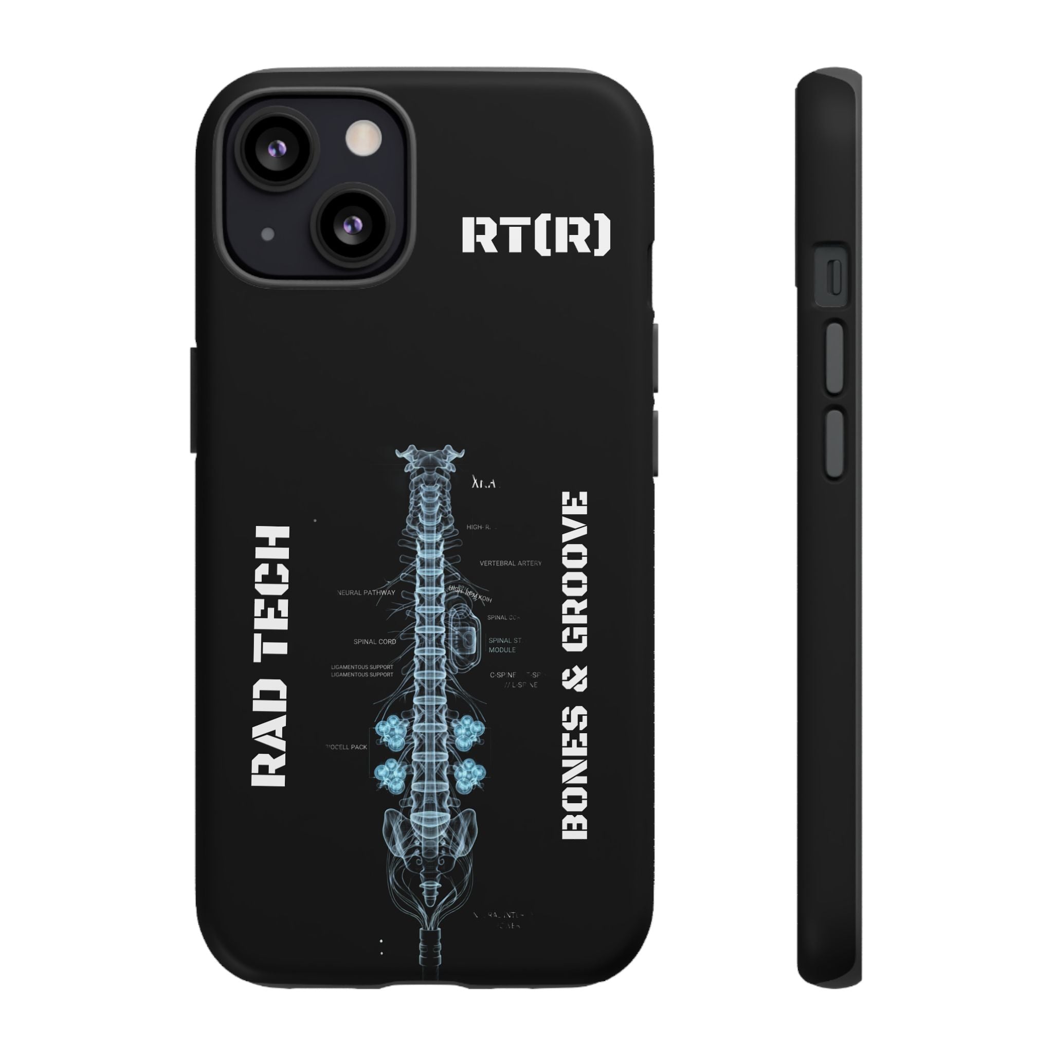 RAD TECH -Aesthetic Phone Case