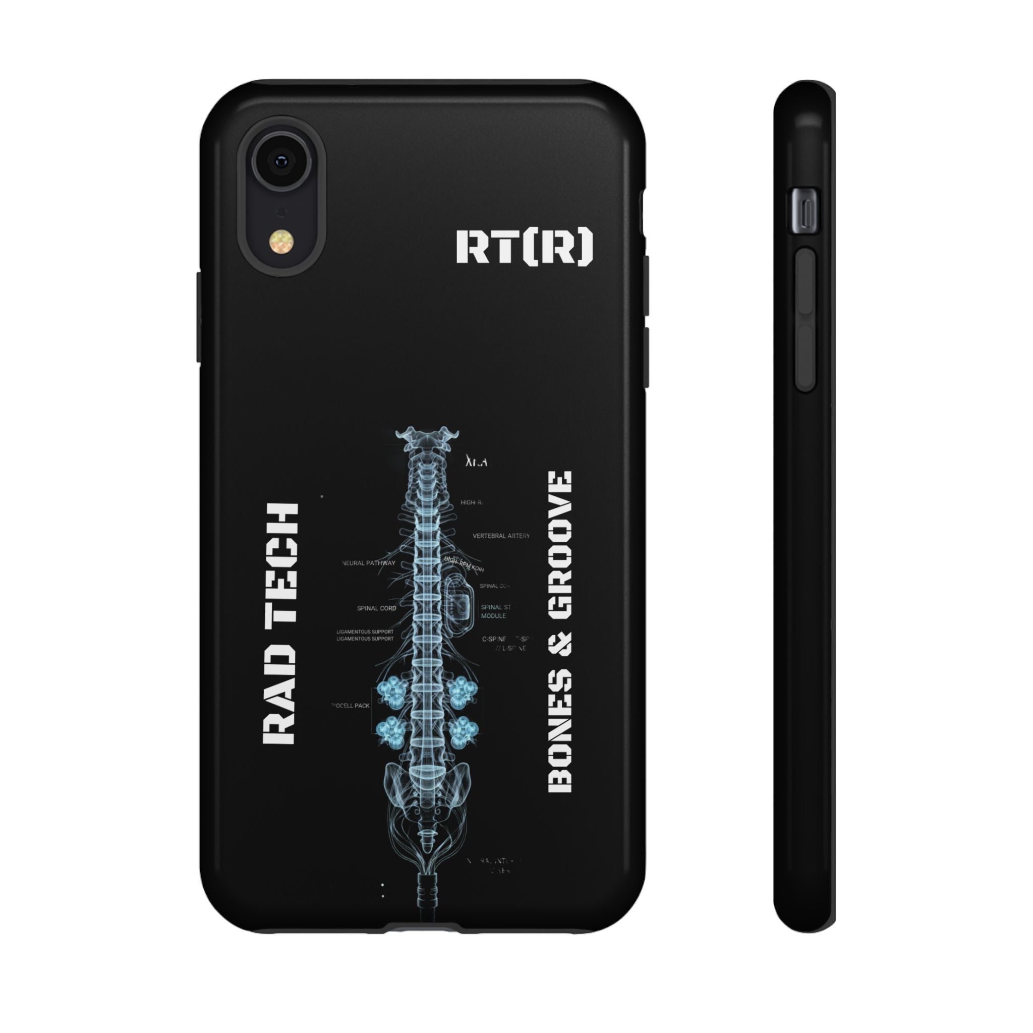RAD TECH -Aesthetic Phone Case