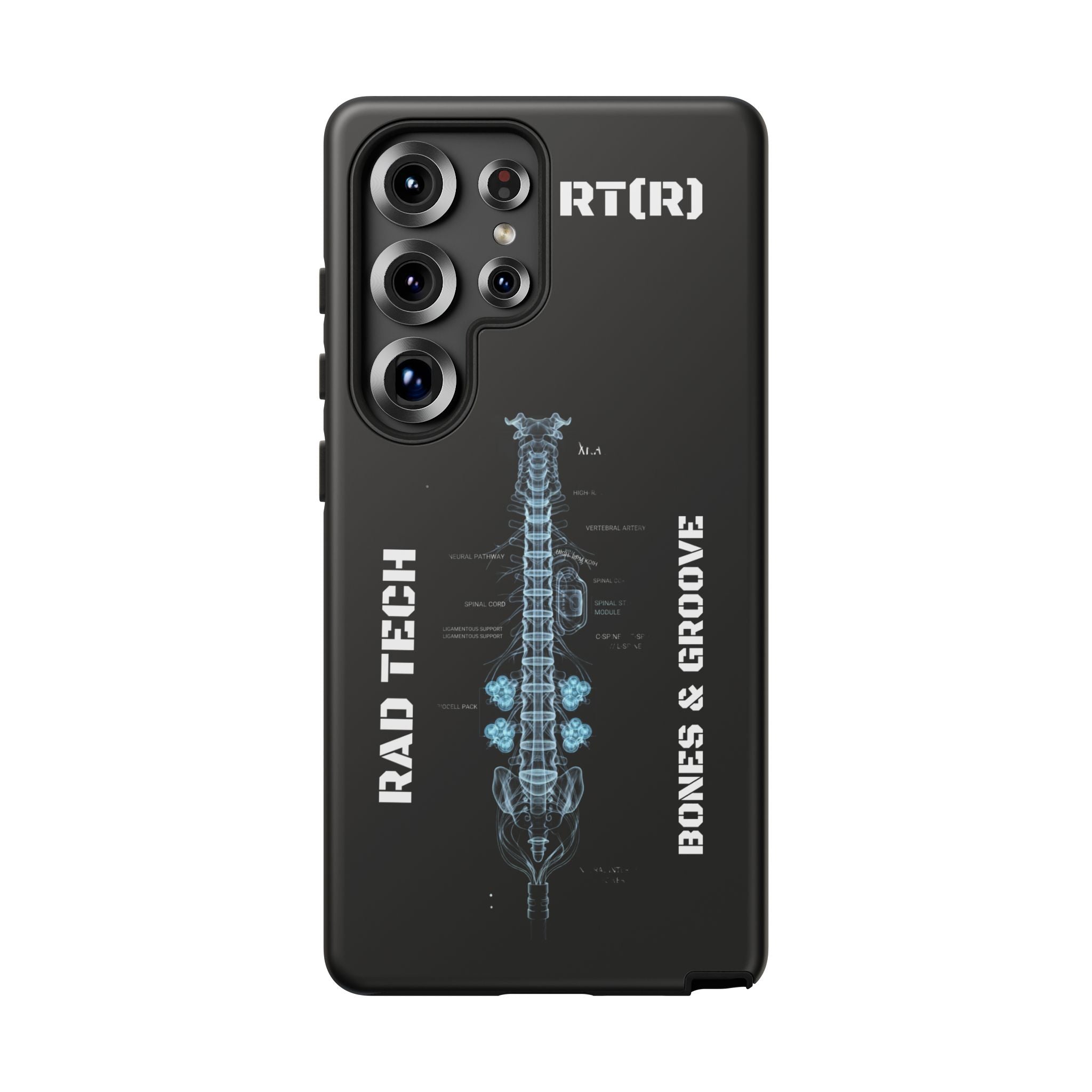 RAD TECH -Aesthetic Phone Case