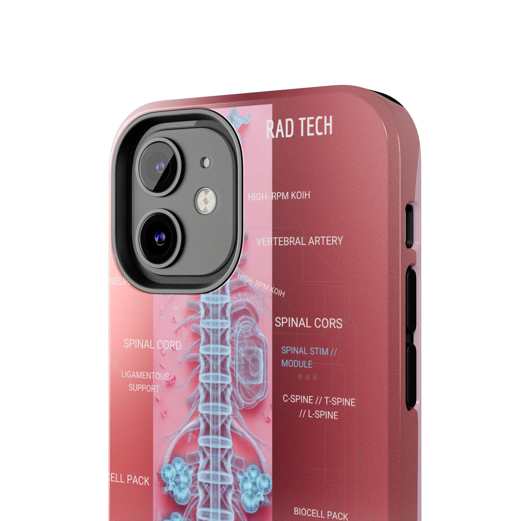 Anatomical Spine Tough Phone Case — Medical X-Ray Design, ‘Spinal Cord’ Labelled