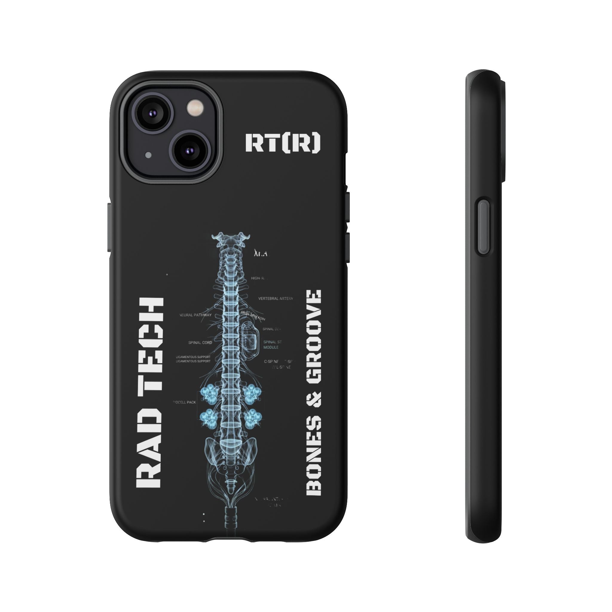 RAD TECH -Aesthetic Phone Case
