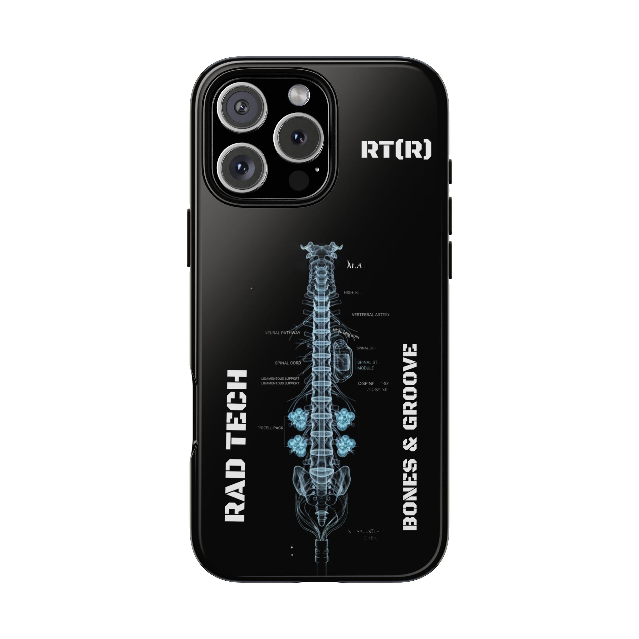 RAD TECH -Aesthetic Phone Case