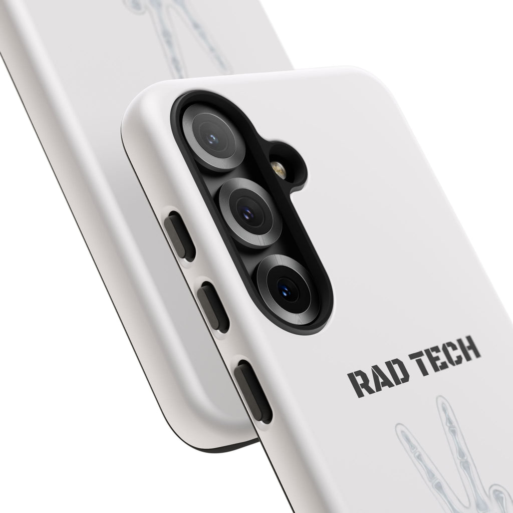 Rad Tech Phone Case — Skeleton Hand "I See Right Through You" X-ray Technician Gift