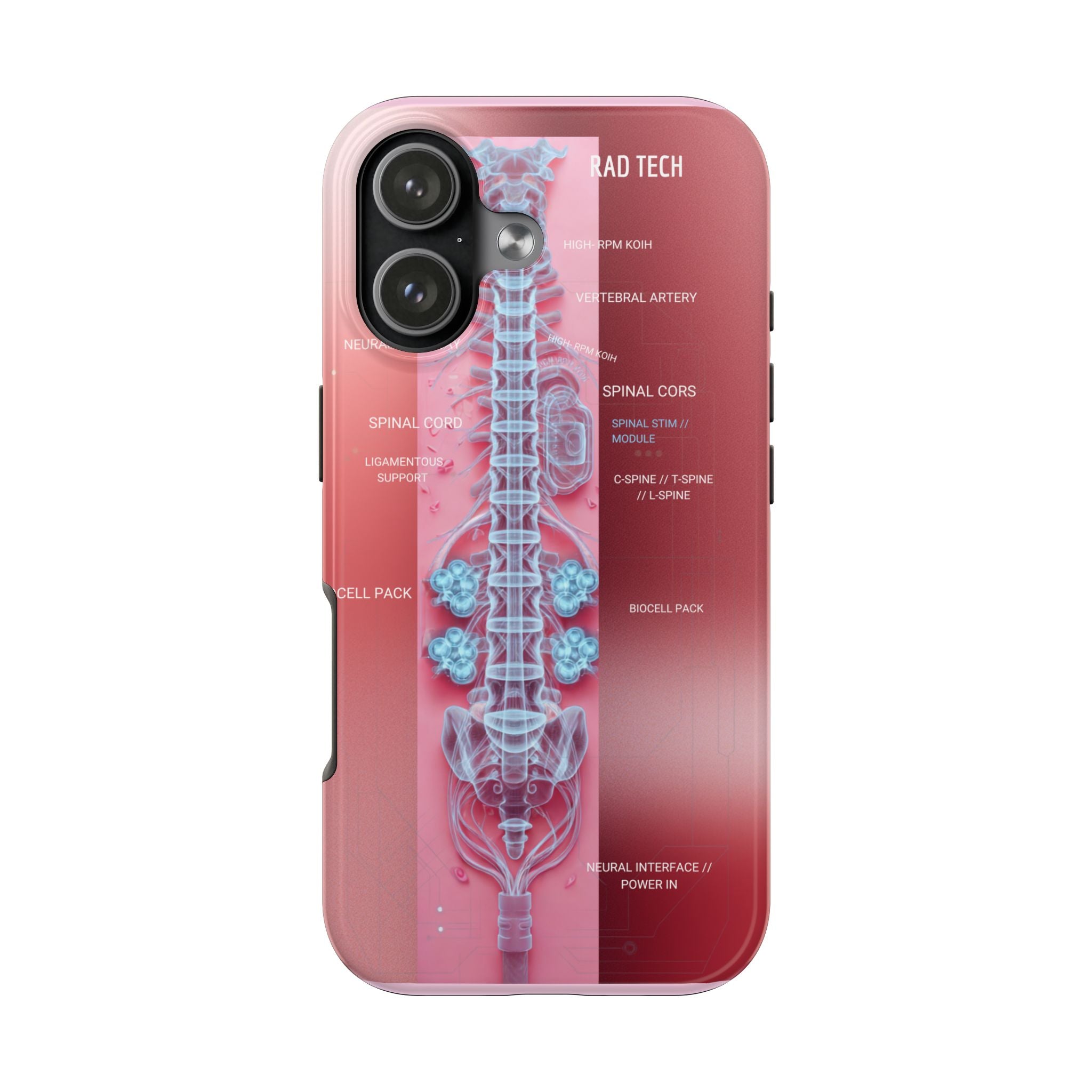 Anatomical Spine Tough Phone Case — Medical X-Ray Design, ‘Spinal Cord’ Labelled