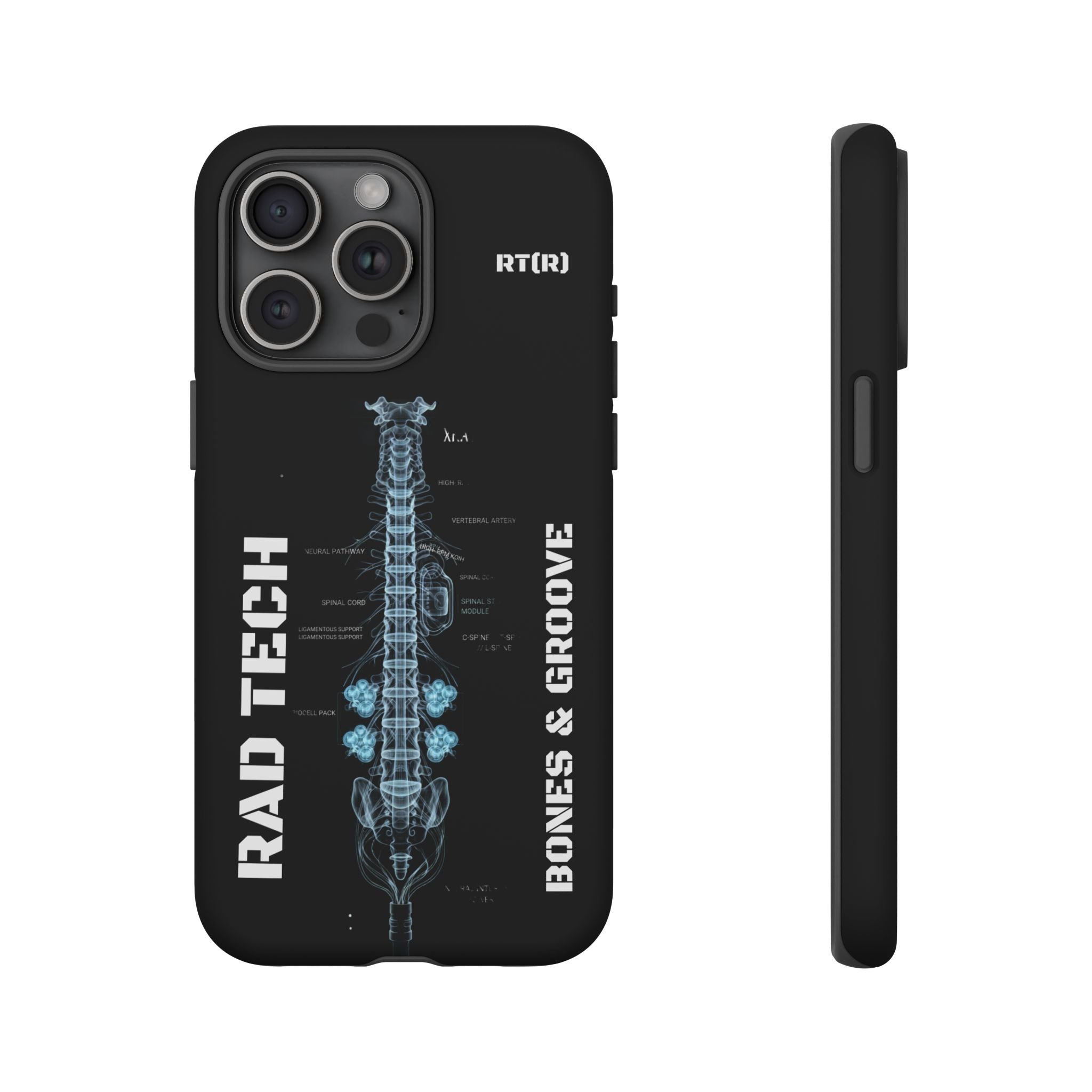 RAD TECH -Aesthetic Phone Case