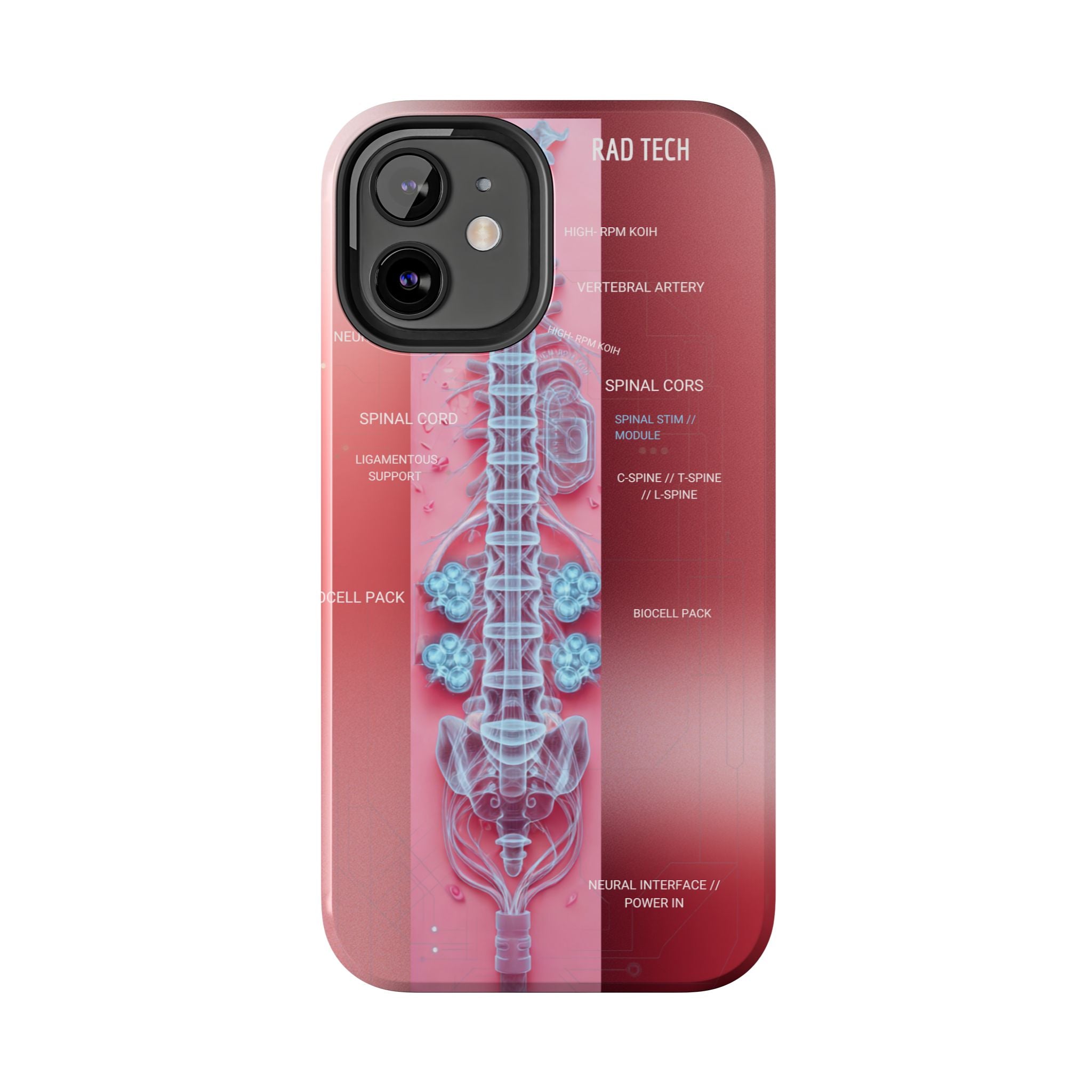 Anatomical Spine Tough Phone Case — Medical X-Ray Design, ‘Spinal Cord’ Labelled